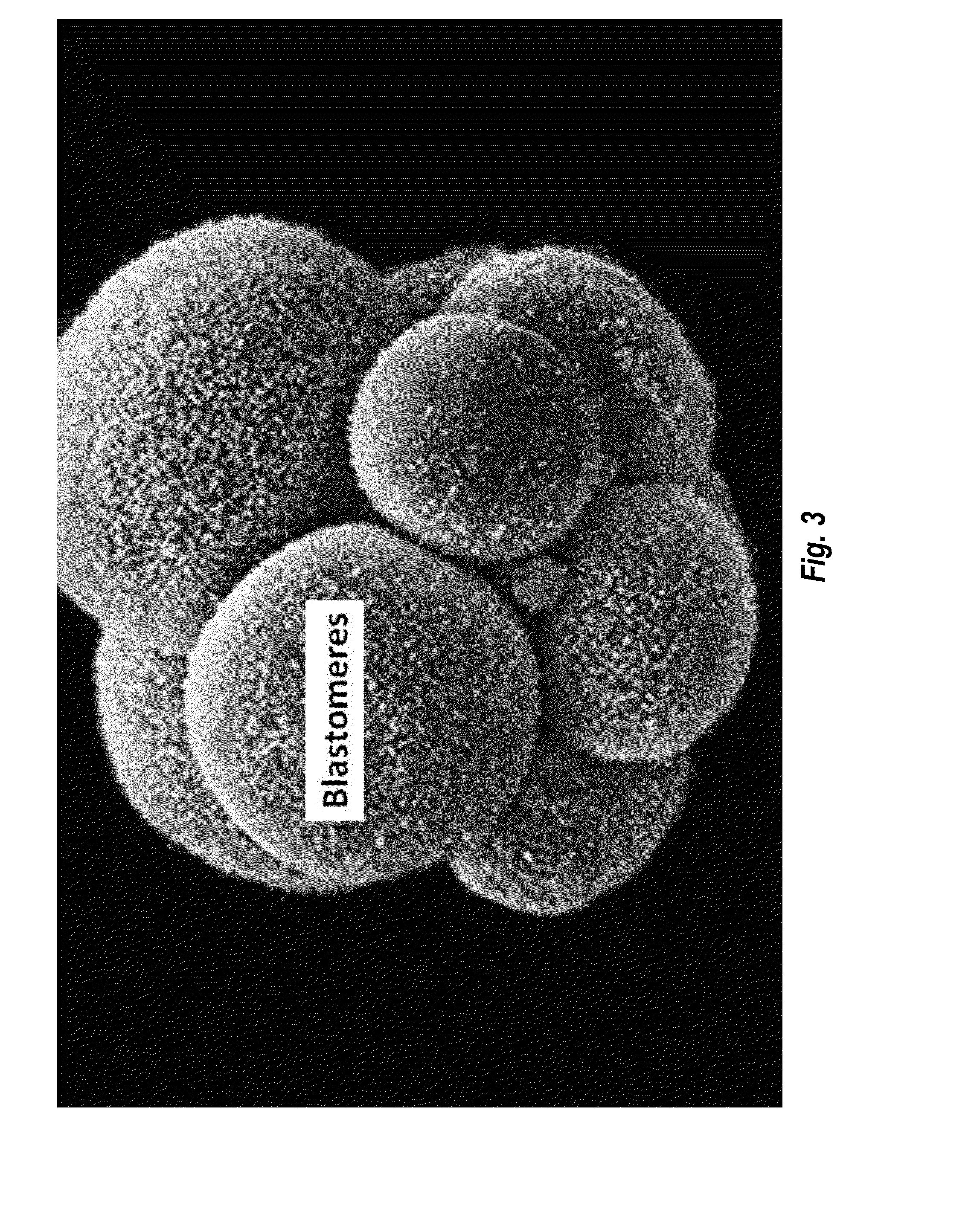 Identification, proliferation in situ, harvesting, separation, and transplantation of adult-derived regenerative pluripotent transitional blastomere-like stem cells and methods of treatment thereof