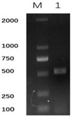 Clonorchis sinensis specific antigen VAL28 and medical application