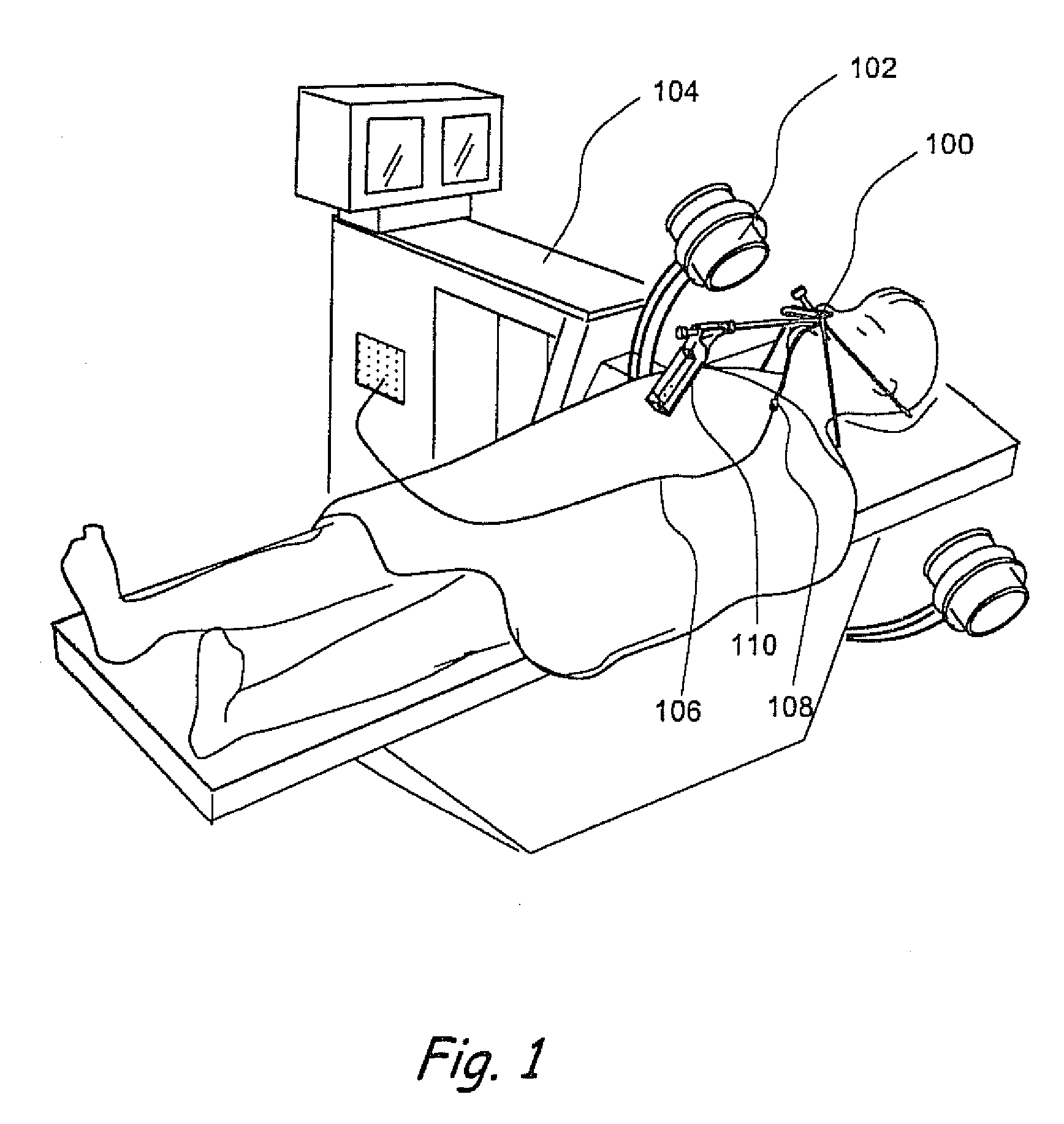 Methods and Apparatus for Treating Disorders of the Ear Nose and Throat