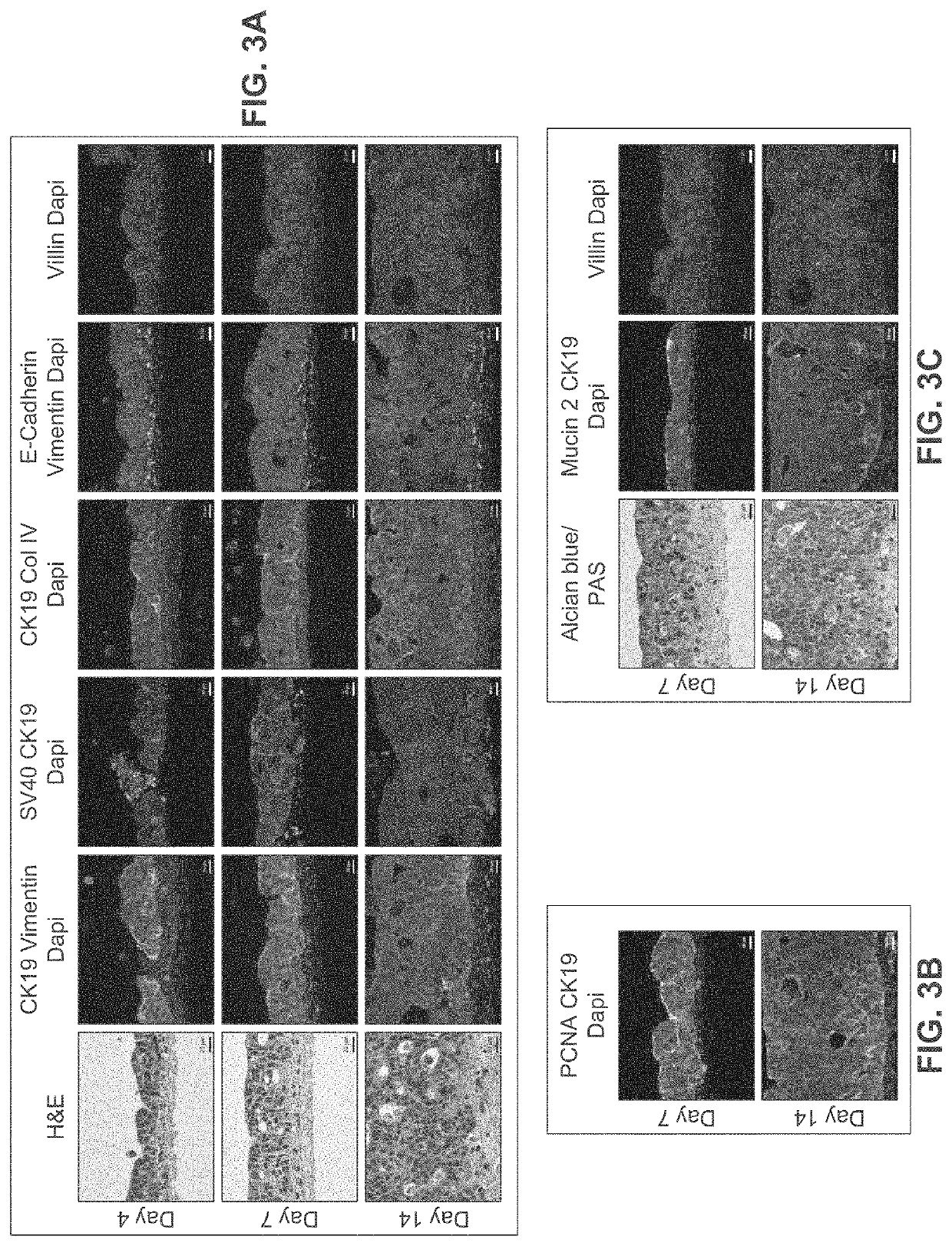 Engineered Intestinal Tissue and Uses Thereof