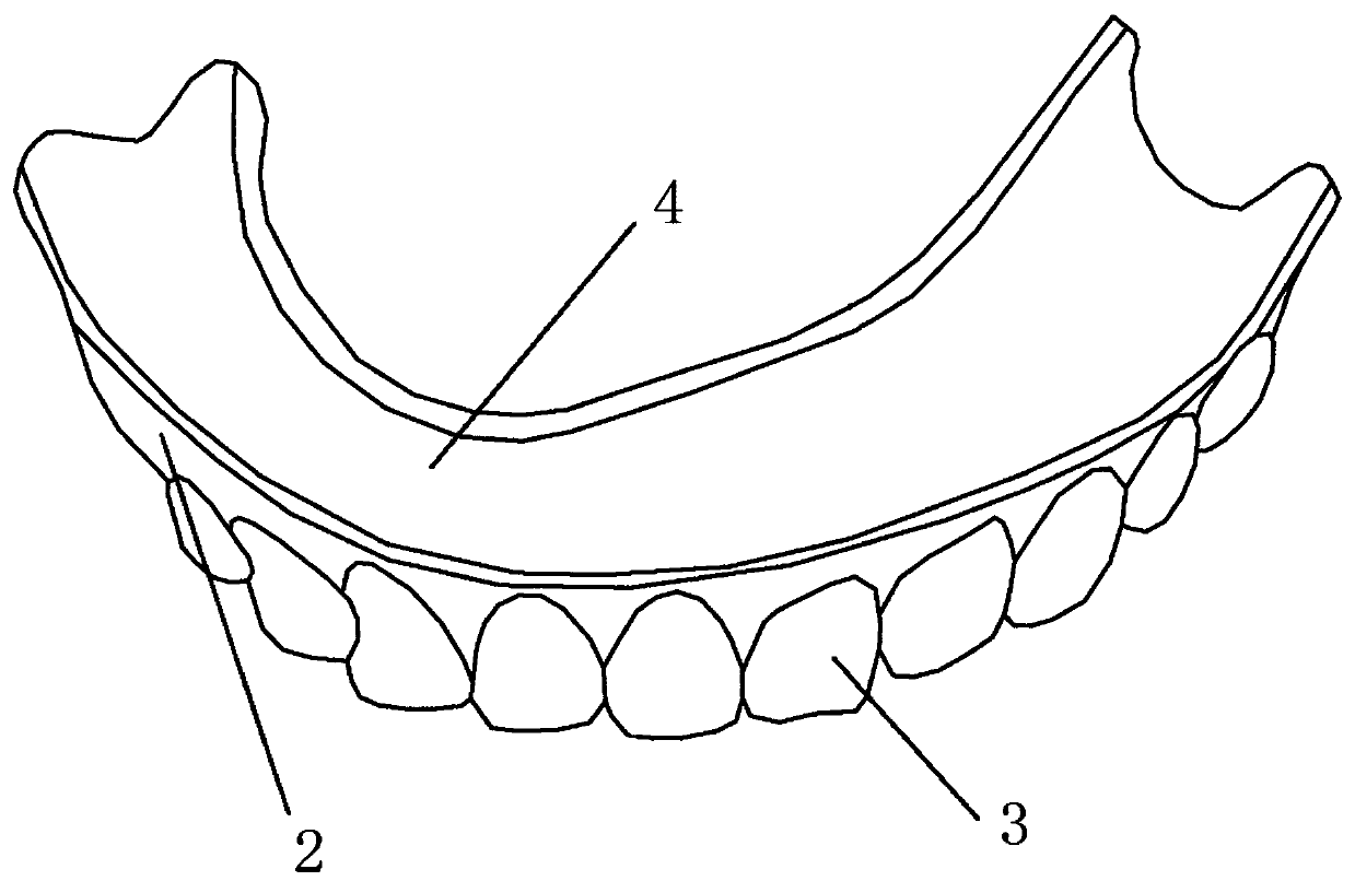 Full denture and preparation method thereof