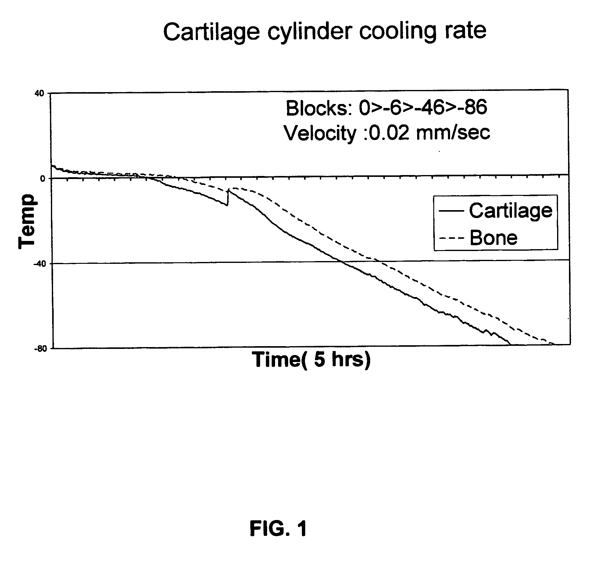 Method for freezing, thawing and transplantation of viable cartilage