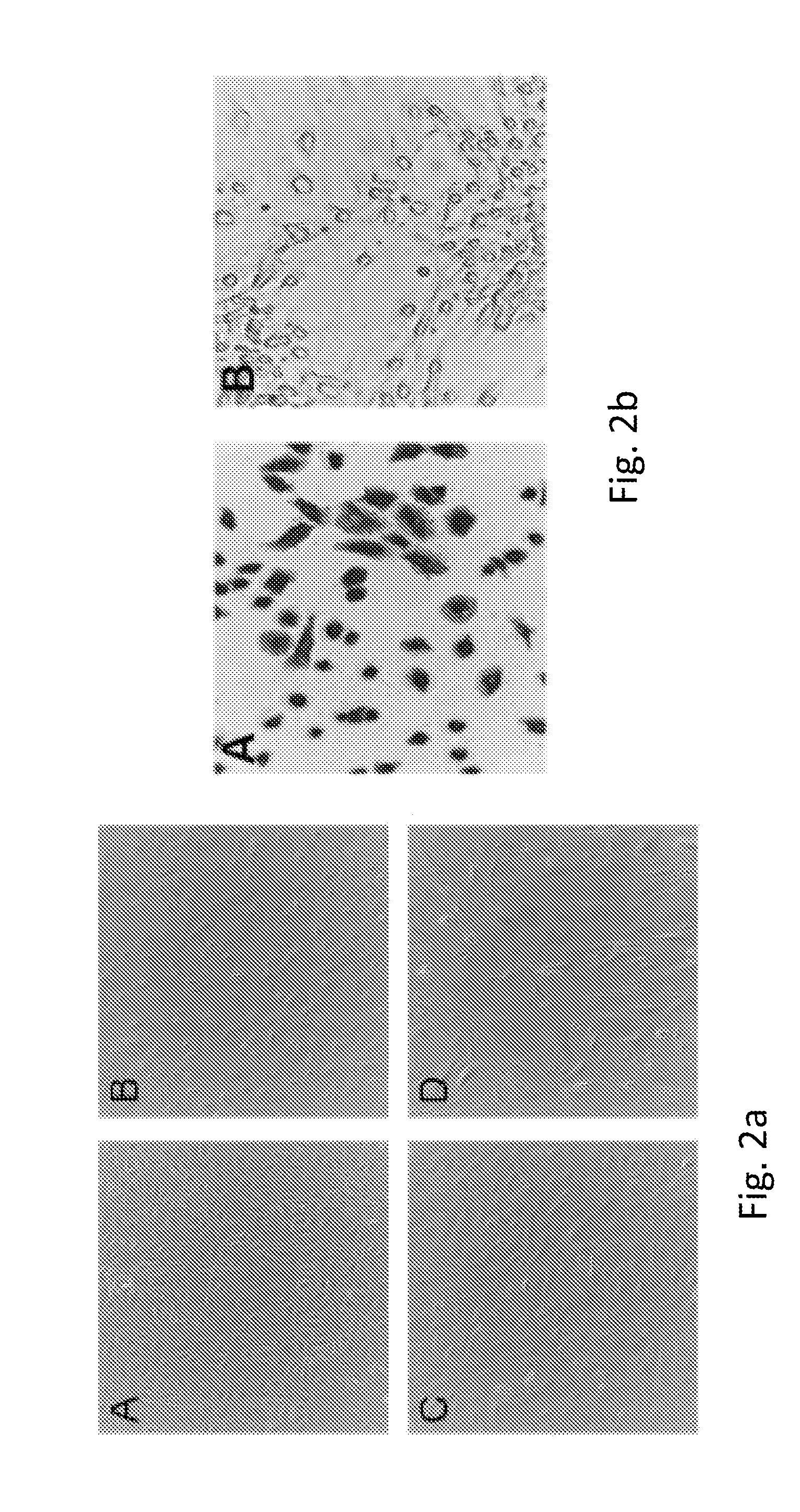 Human omental mesothelial cells, methods of isolation and uses thereof