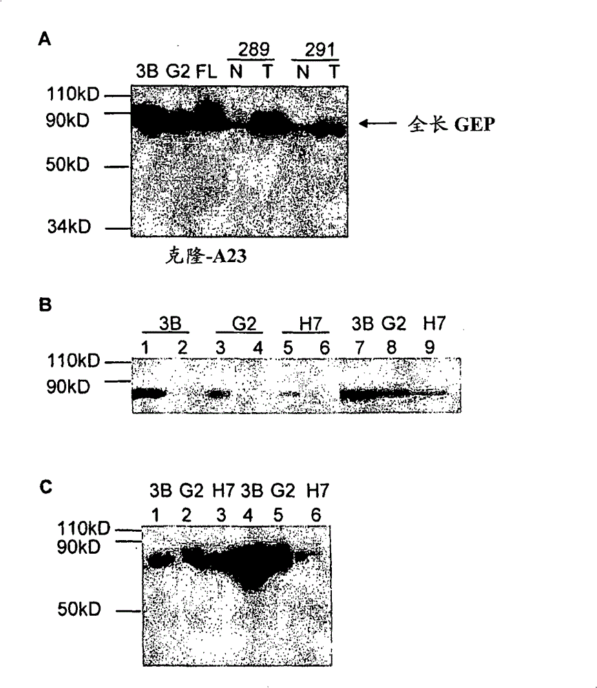 The use of granulin-epithelin precursor (GEP) antibodies for detection and suppression of hepatocellular carcinoma (HCC)