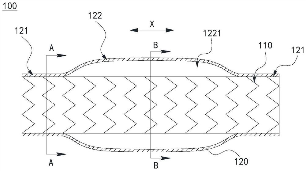 Stent artificial blood vessel