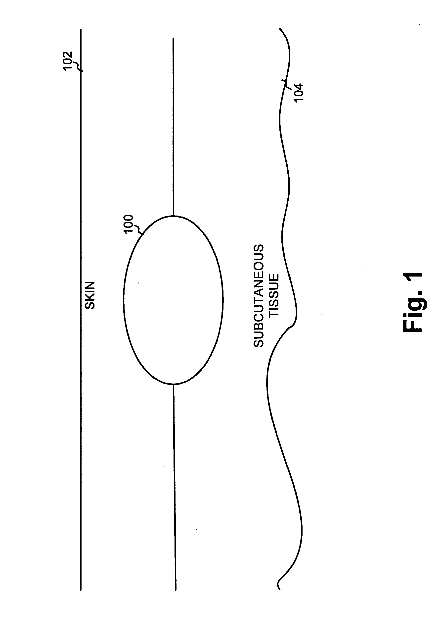 Attached personal information device