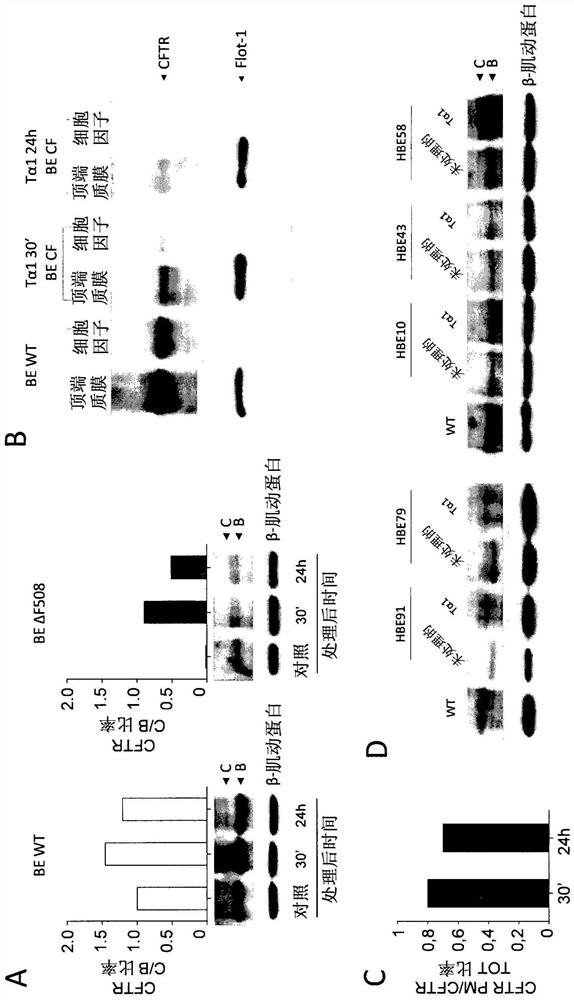 Use of thymosin alpha 1 for the treatment of cystic fibrosis