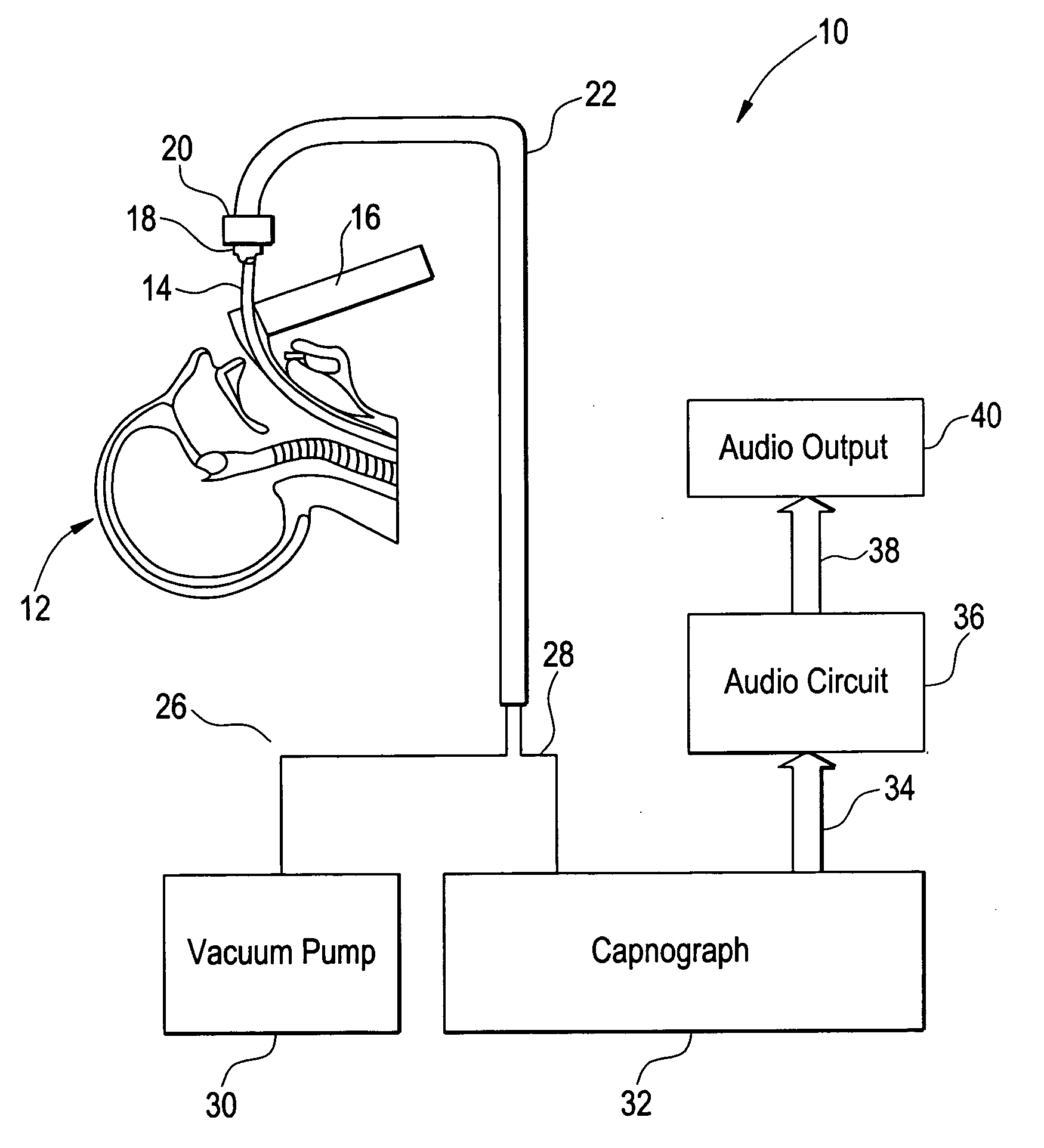 Method and apparatus for capnography-guided intubation