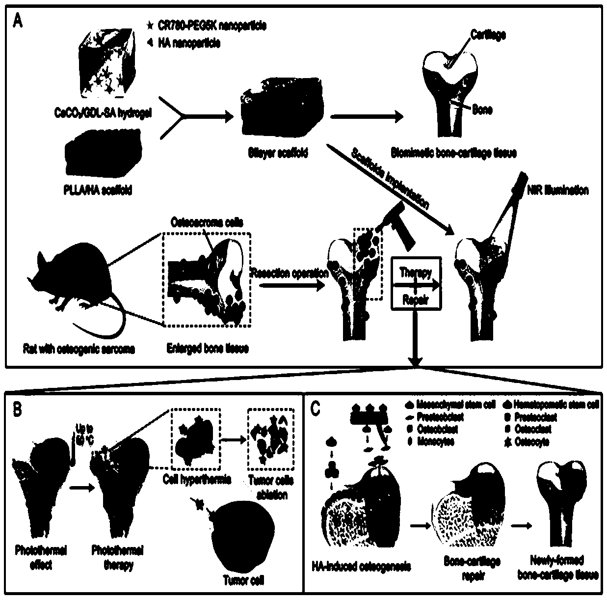 Difunctional integrated bone-cartilage composite tissue engineering scaffold for clinic treatment of osteosarcoma