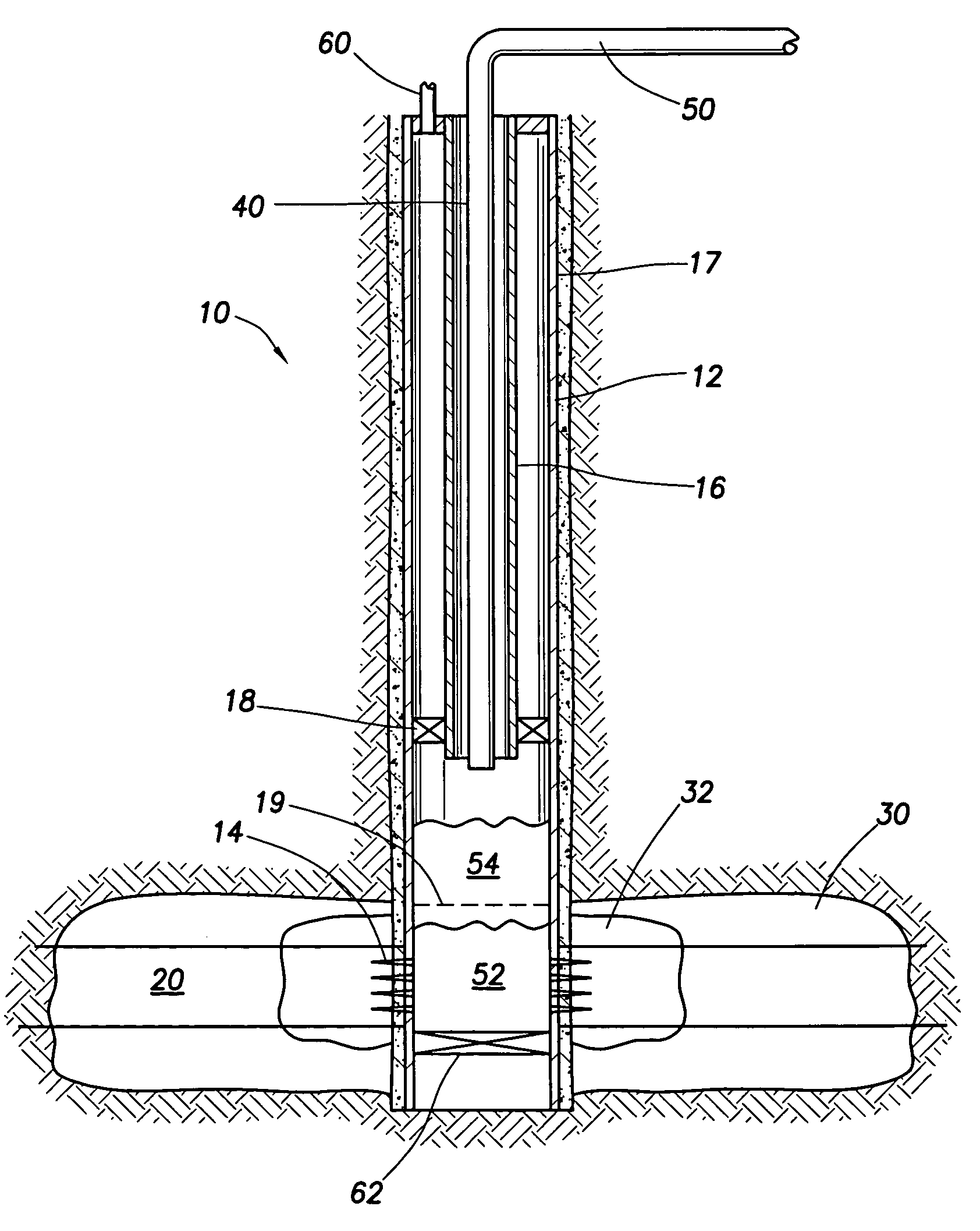 Method for hydraulic fracturing with squeeze pressure
