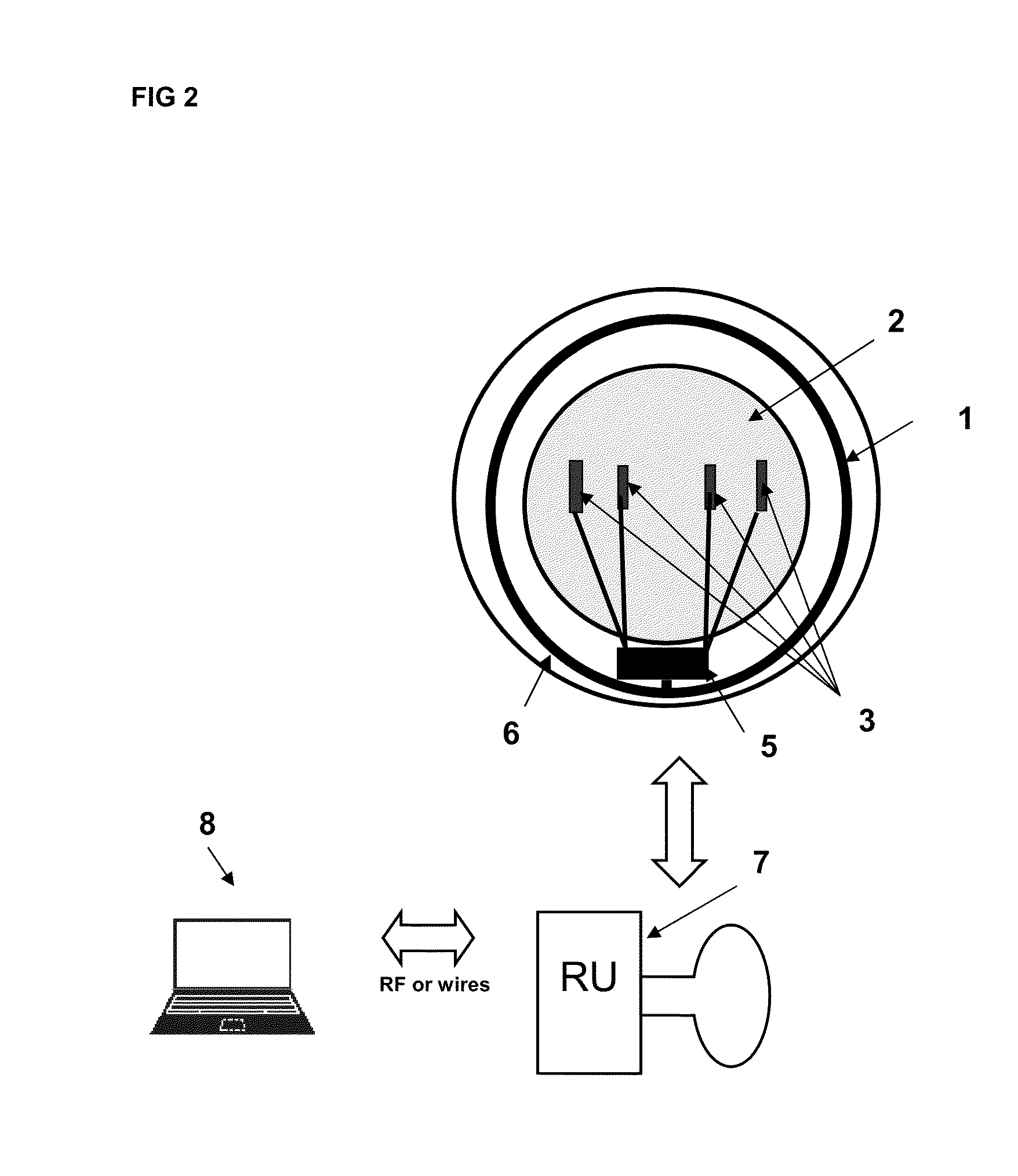 Sensor contact lens, system for the non-invasive monitoring of intraocular pressure and method for measuring same