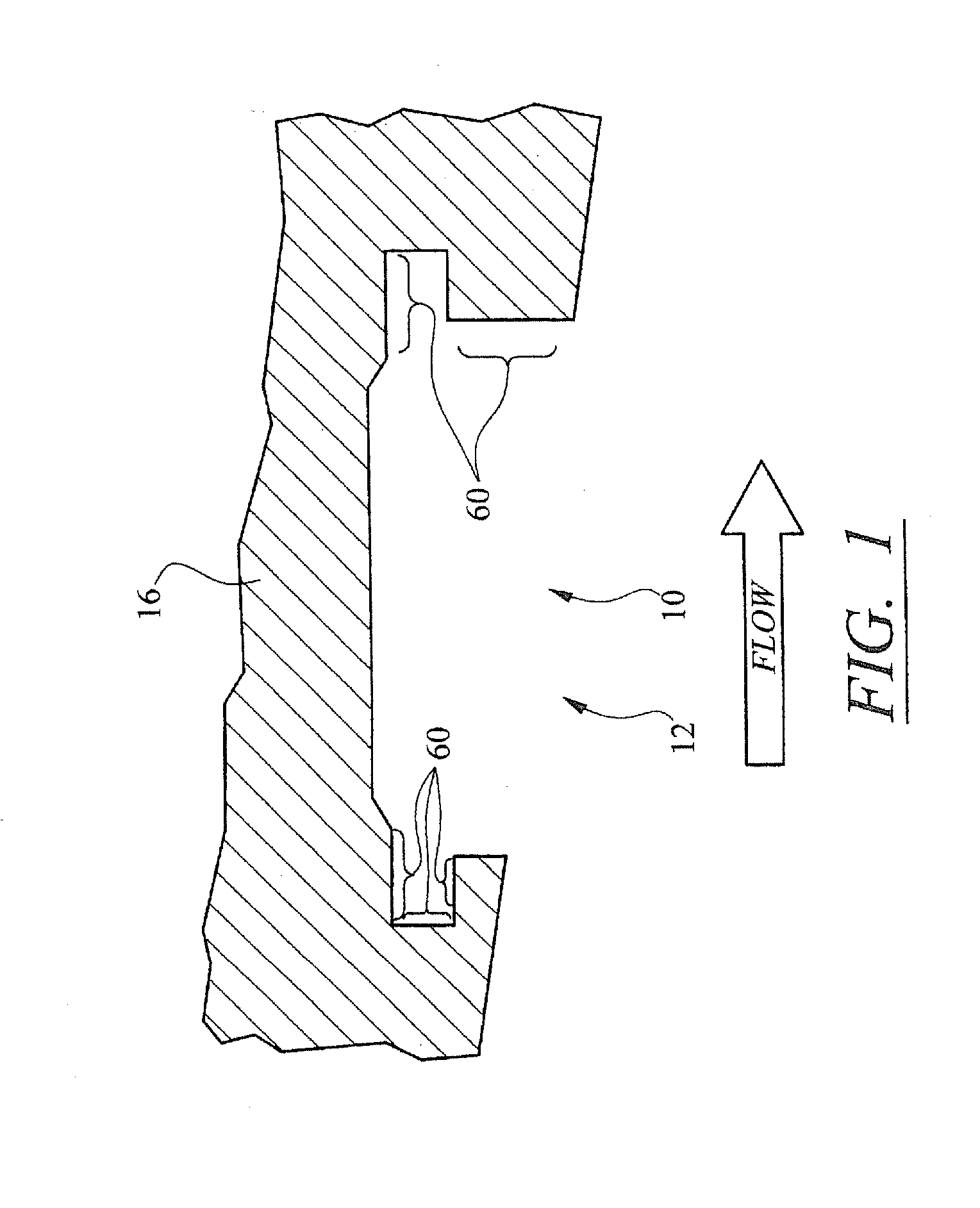 System for restoring turbine vane attachment systems in a turbine engine