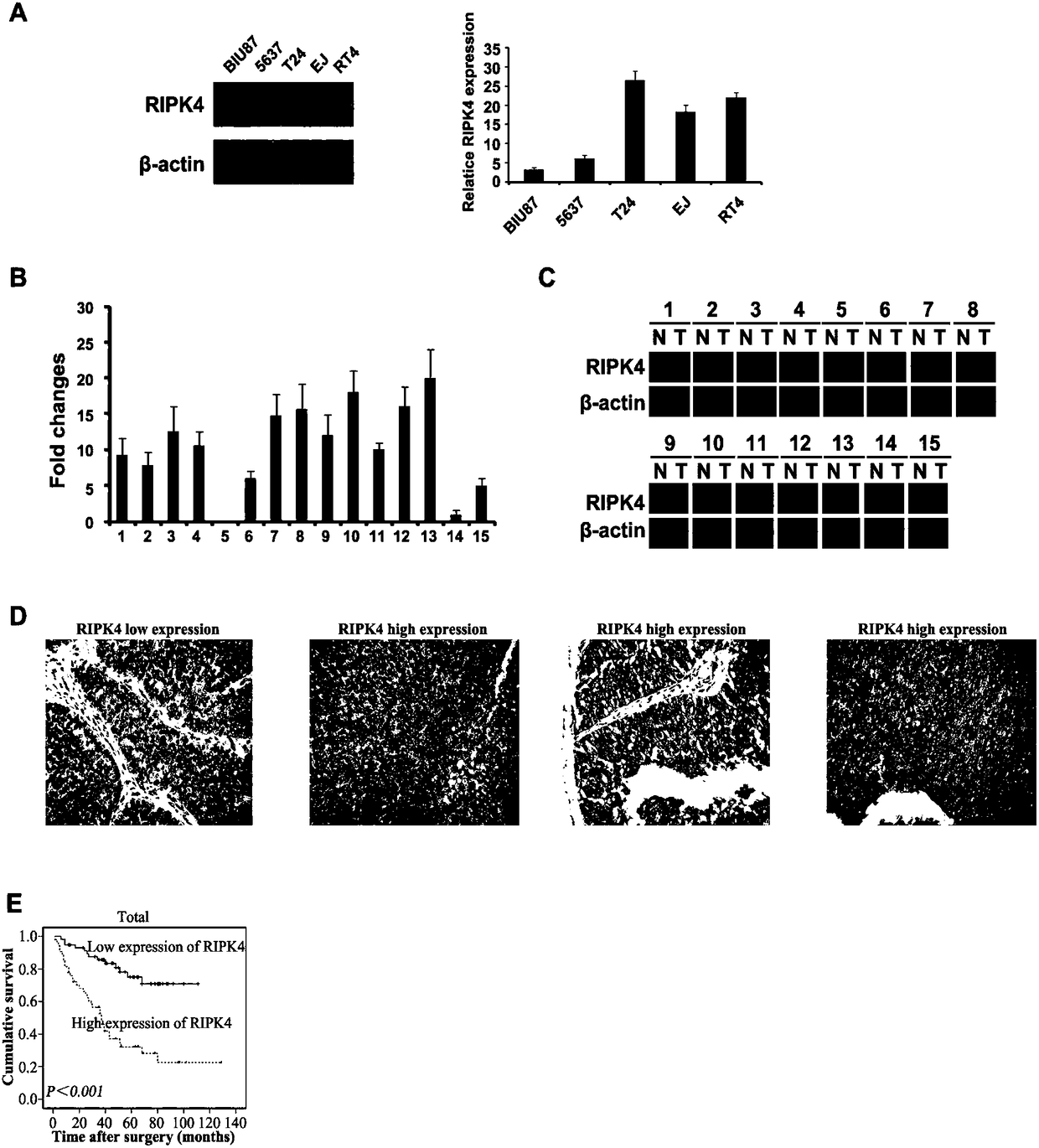 Application of RIPK4 as target site in preparing urinary bladder carcinoma treating medicine