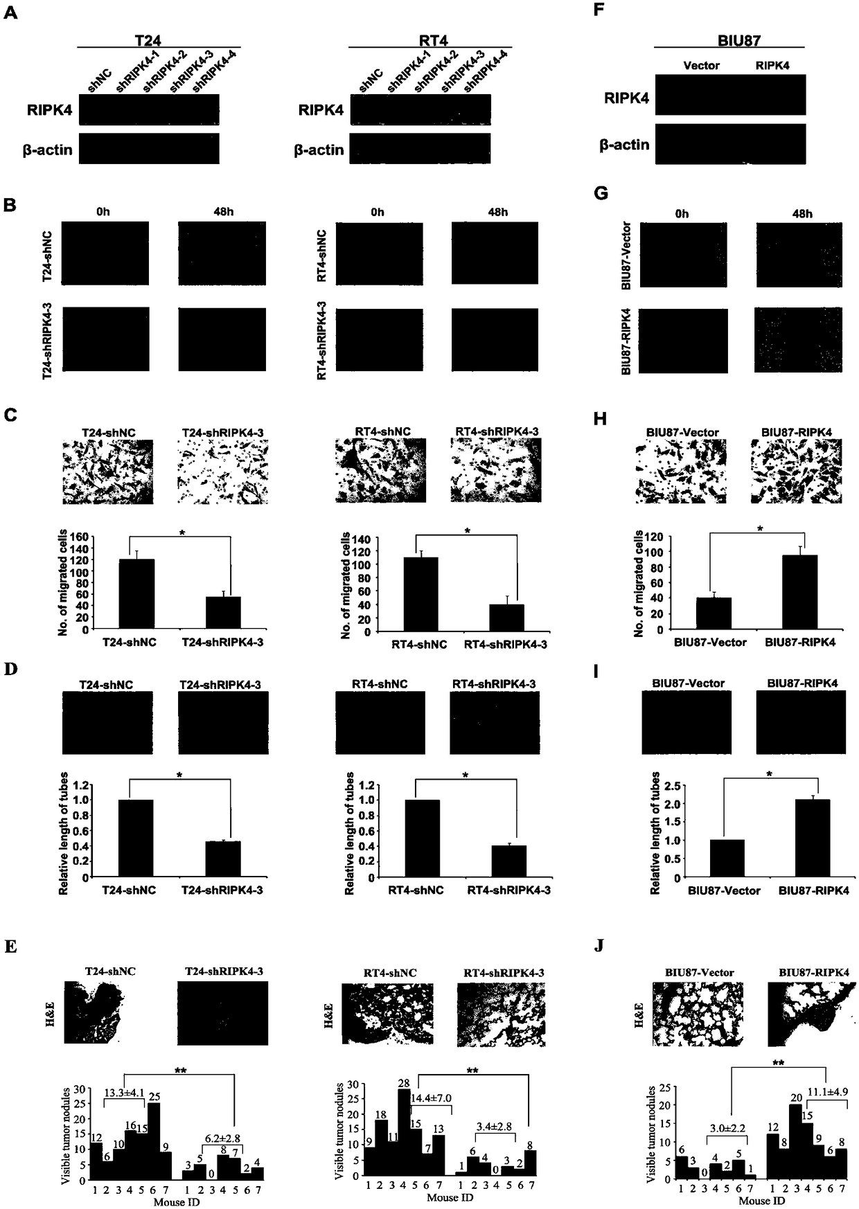 Application of RIPK4 as target site in preparing urinary bladder carcinoma treating medicine