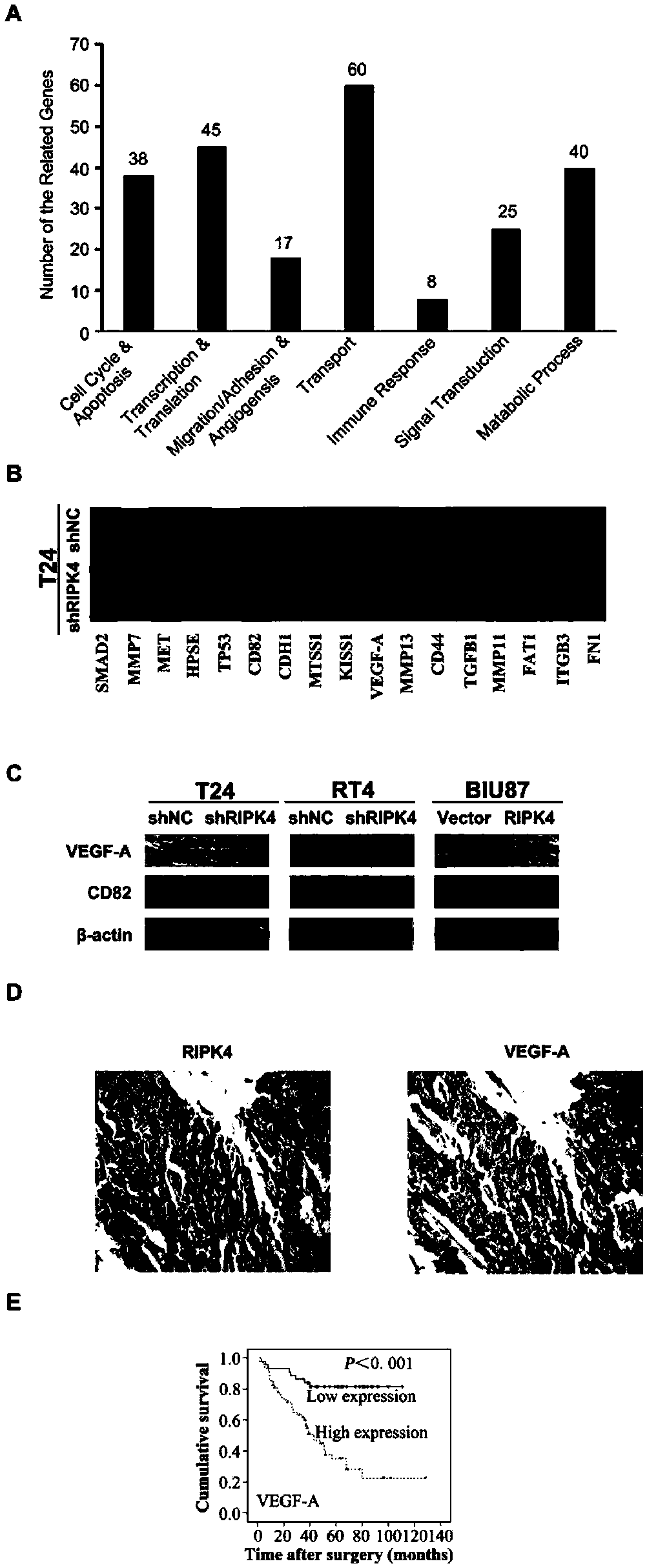 Application of RIPK4 as target site in preparing urinary bladder carcinoma treating medicine