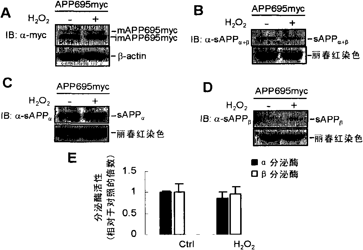 Function of small RNA molecule aiming at c-Jun amino terminal kinase of human for senile dementia