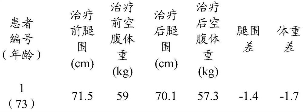 Traditional Chinese medicine composition for promoting blood circulation to remove blood stasis and preparation method and application thereof