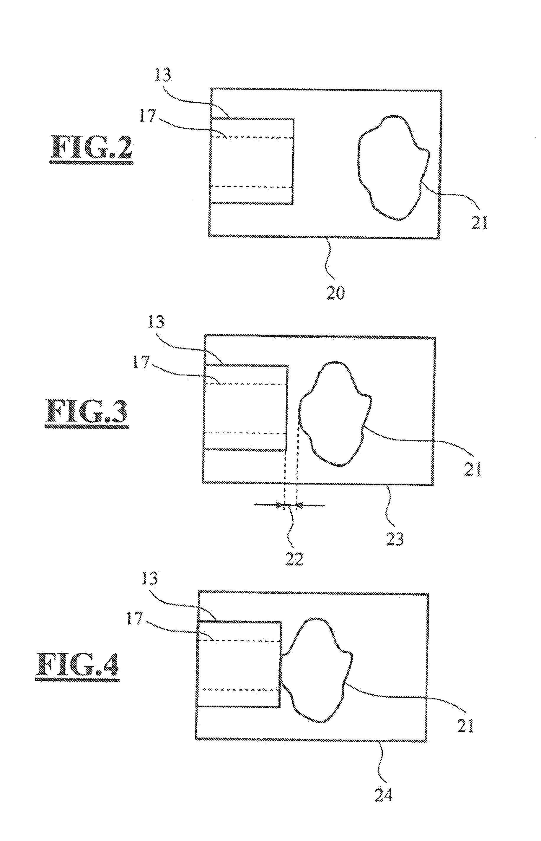 Ophthalmic surgical system and control arrangement therefor