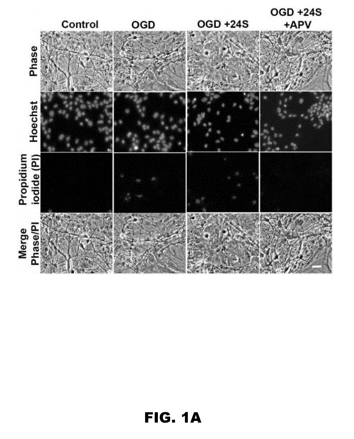 25-hydroxycholesterol and methods of use thereof