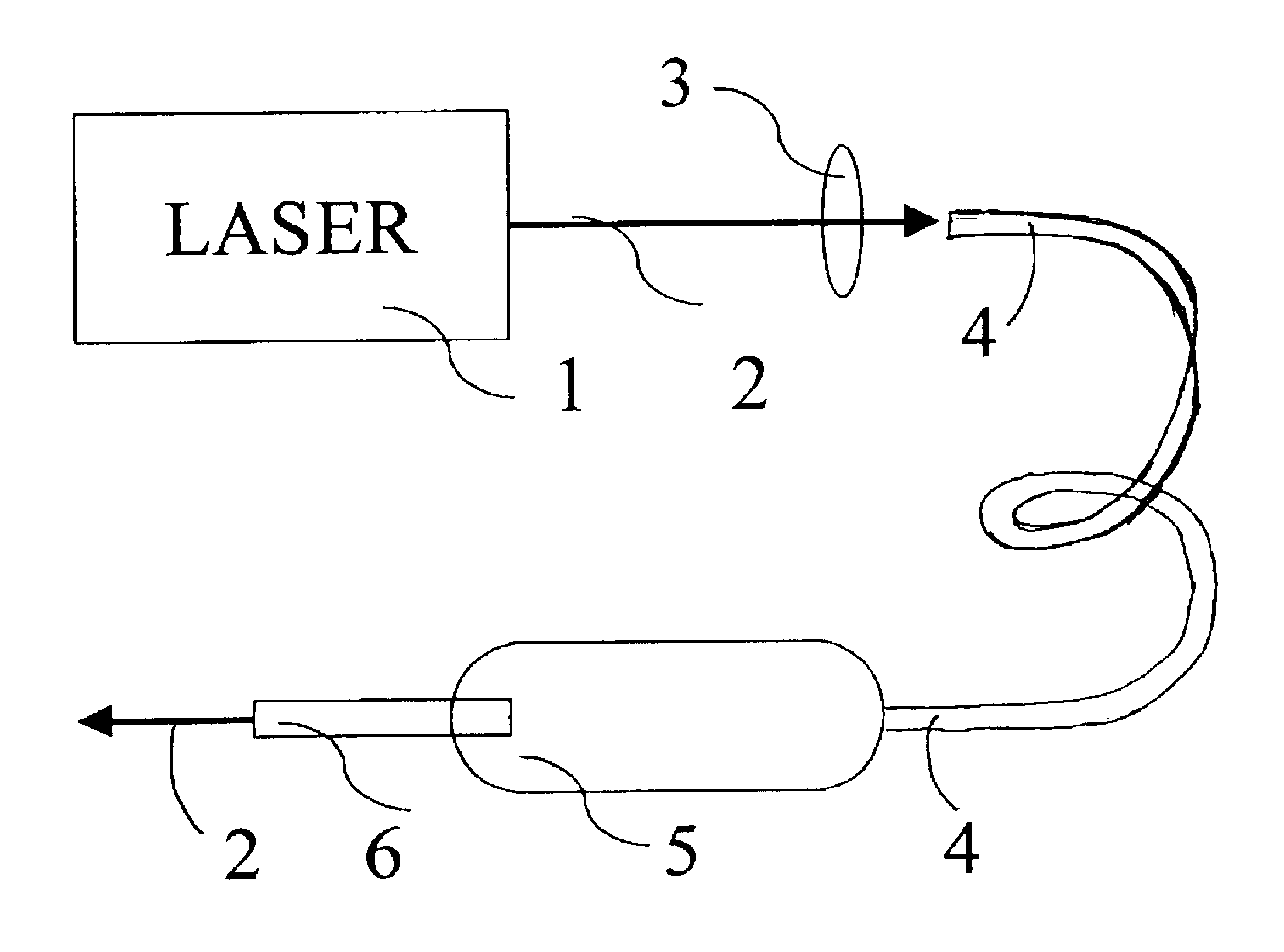 Apparatus and methods for the treatment of presbyopia using fiber-coupled-lasers
