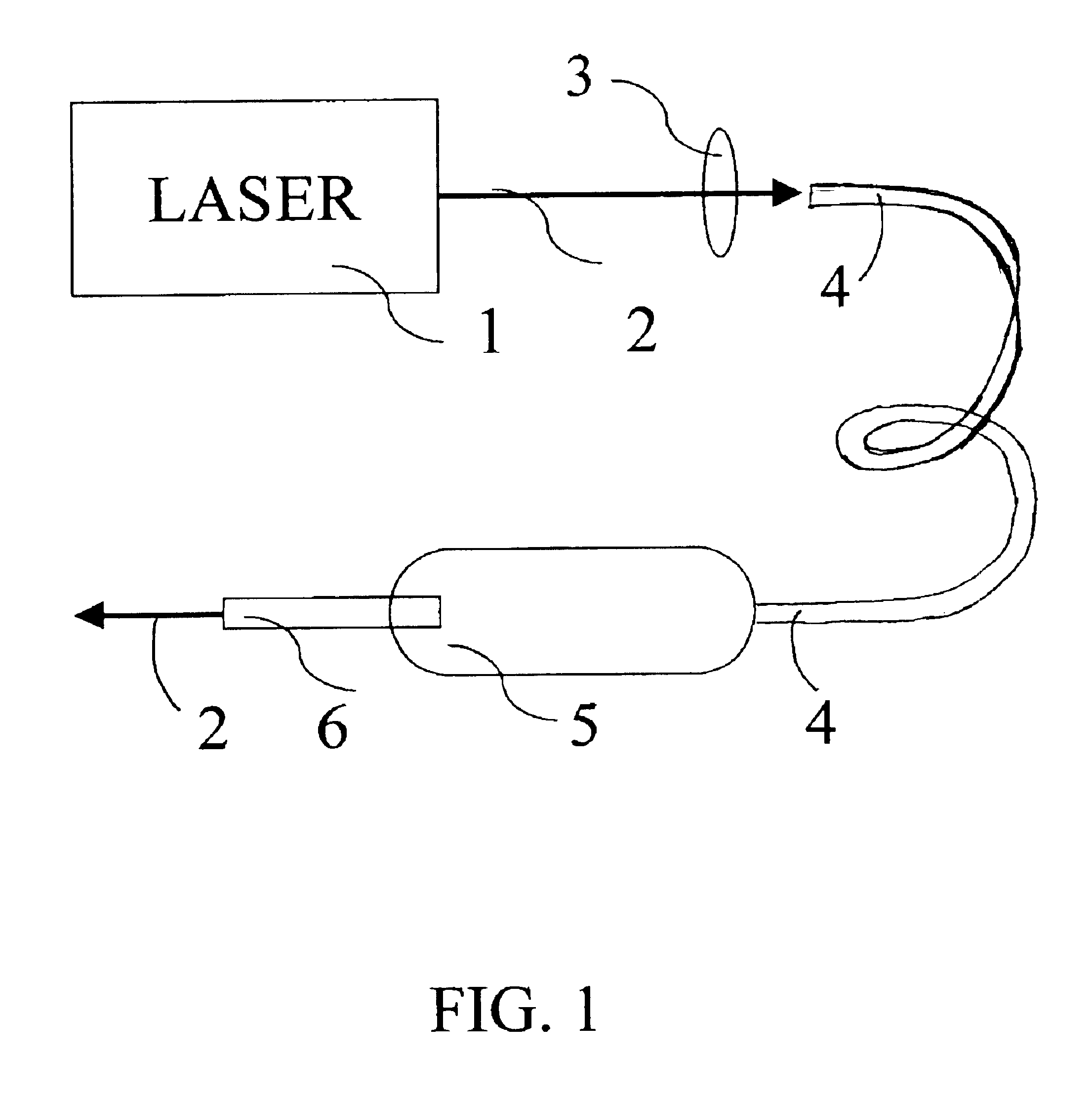 Apparatus and methods for the treatment of presbyopia using fiber-coupled-lasers