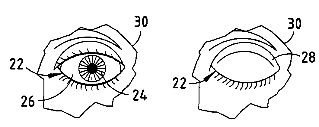 Drowsiness detection system and method