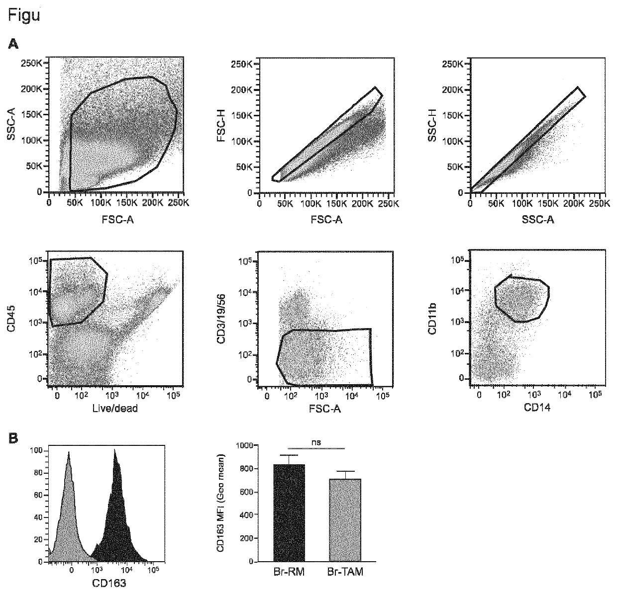 Macrophage markers in cancer