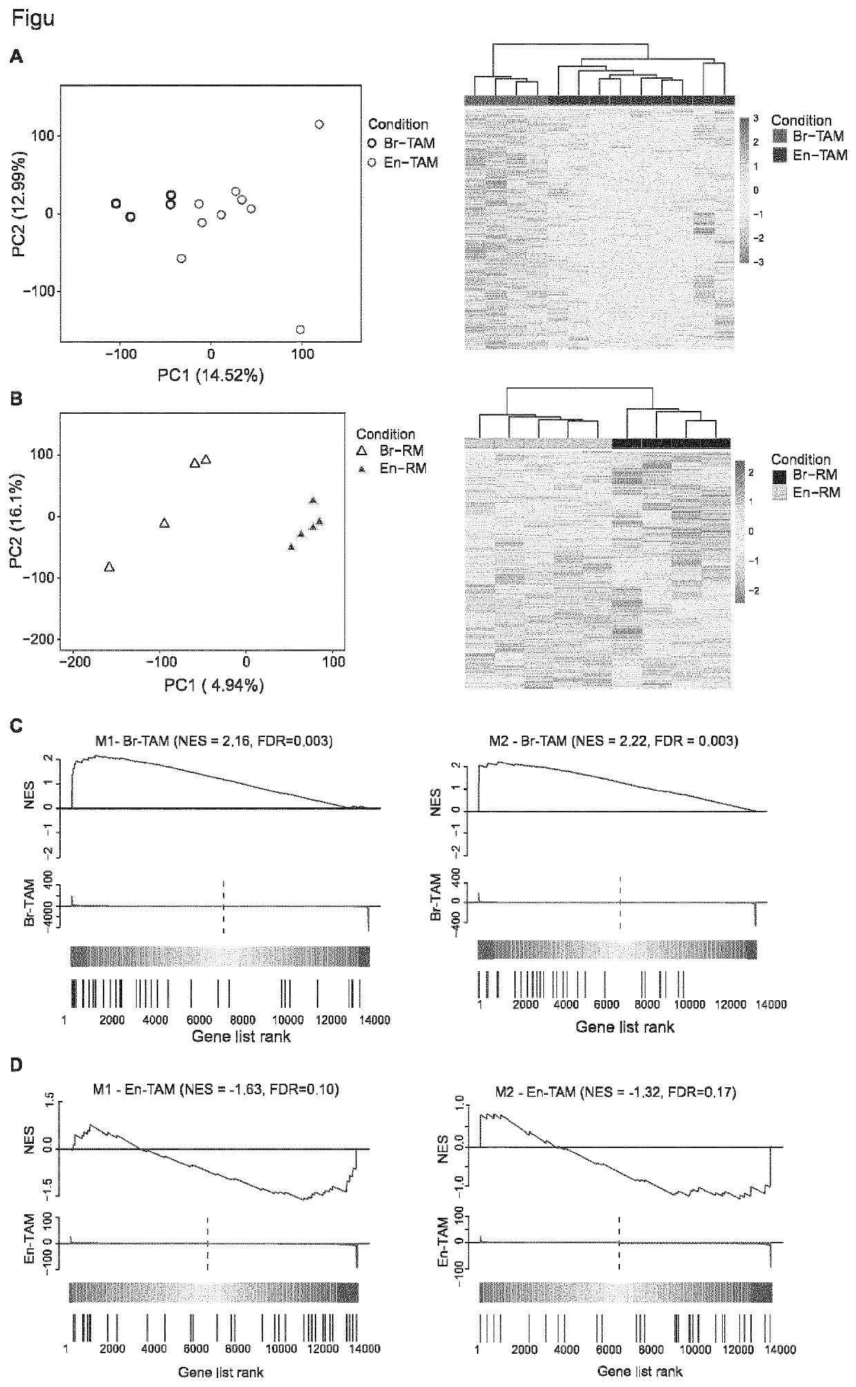 Macrophage markers in cancer