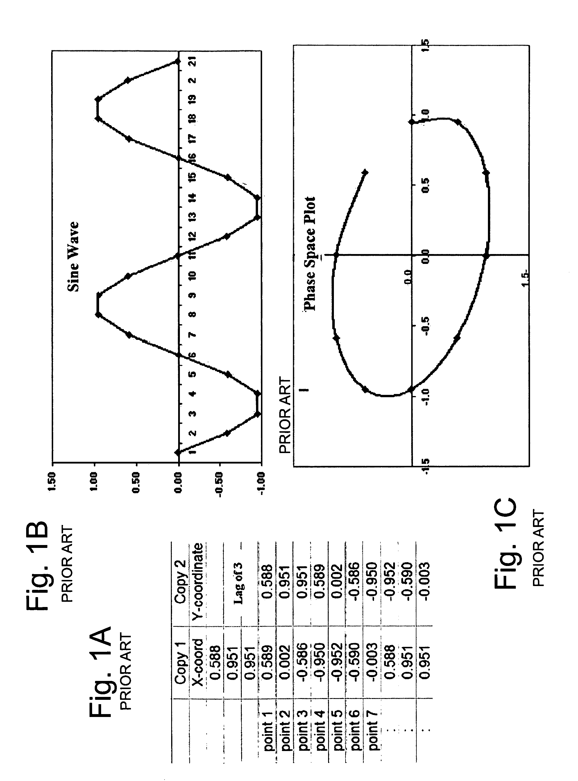 Devices, systems and methods for characterization of ventricular fibrillation and for treatment of ventricular fibrillation