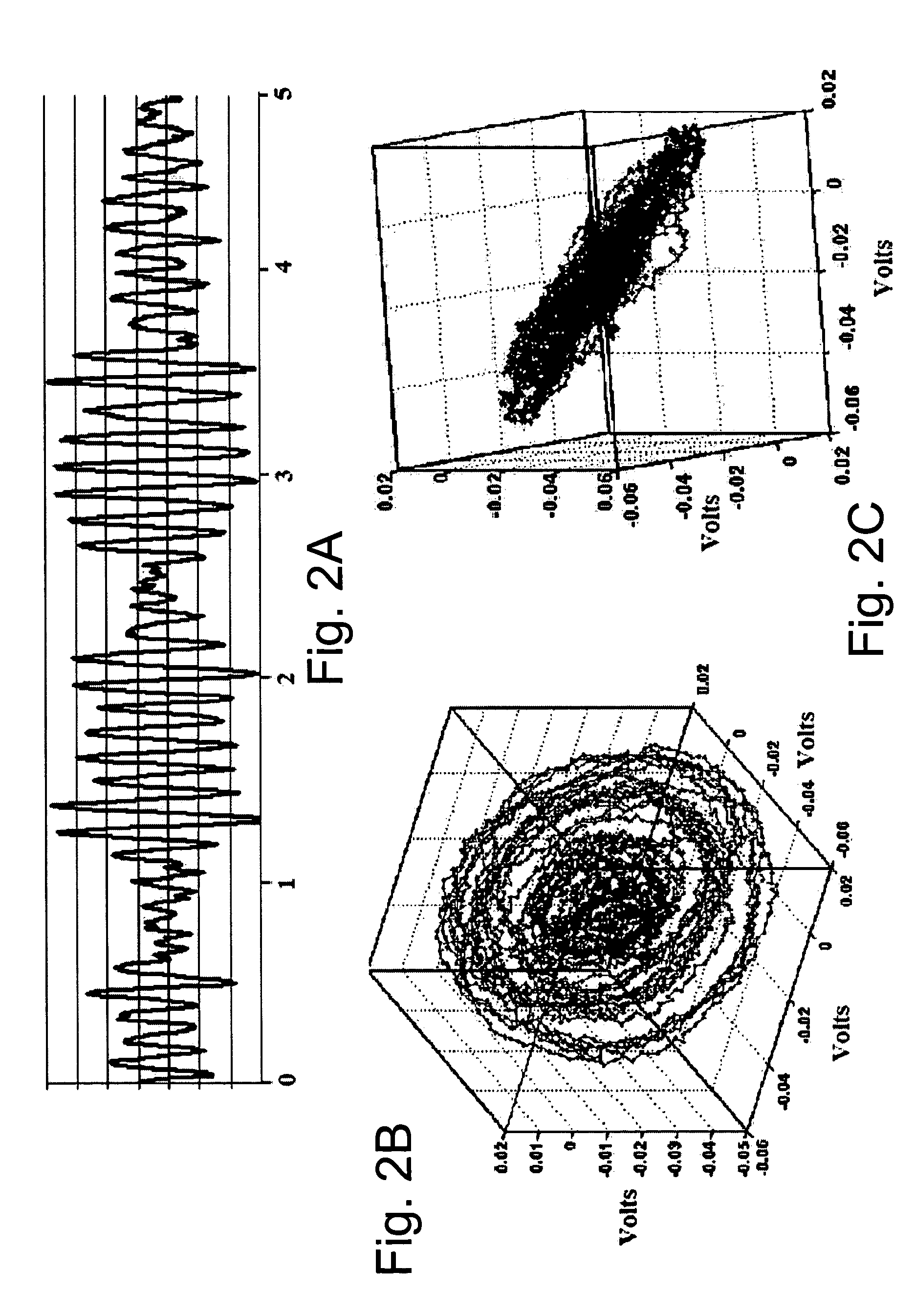 Devices, systems and methods for characterization of ventricular fibrillation and for treatment of ventricular fibrillation