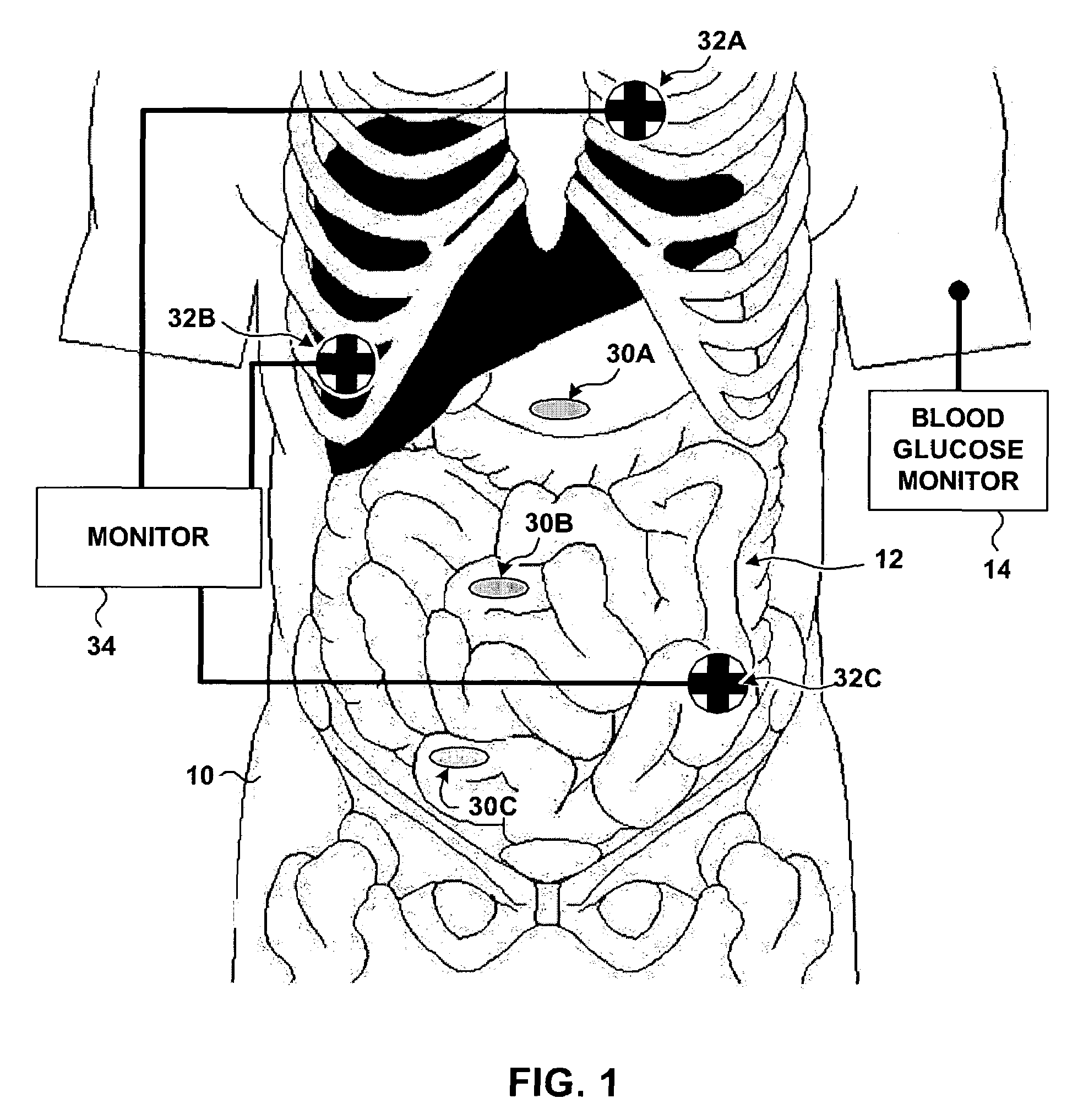 Systems and methods for monitoring gastrointestinal system