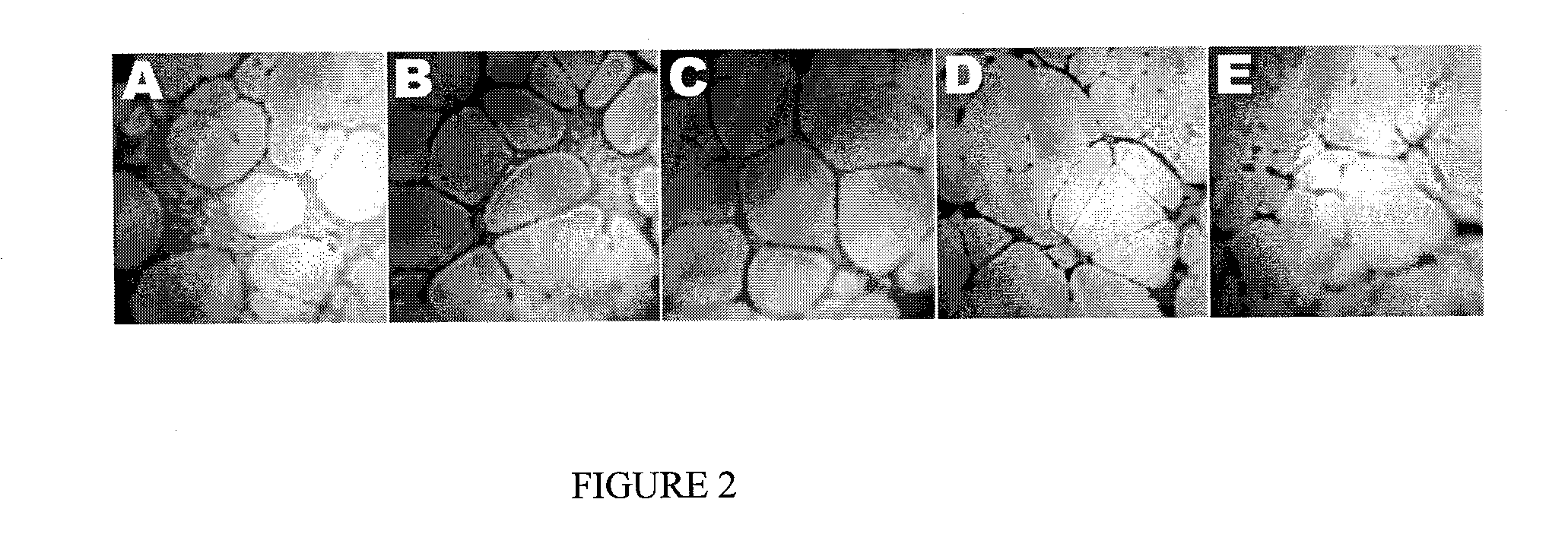 Method for treatment of diseases