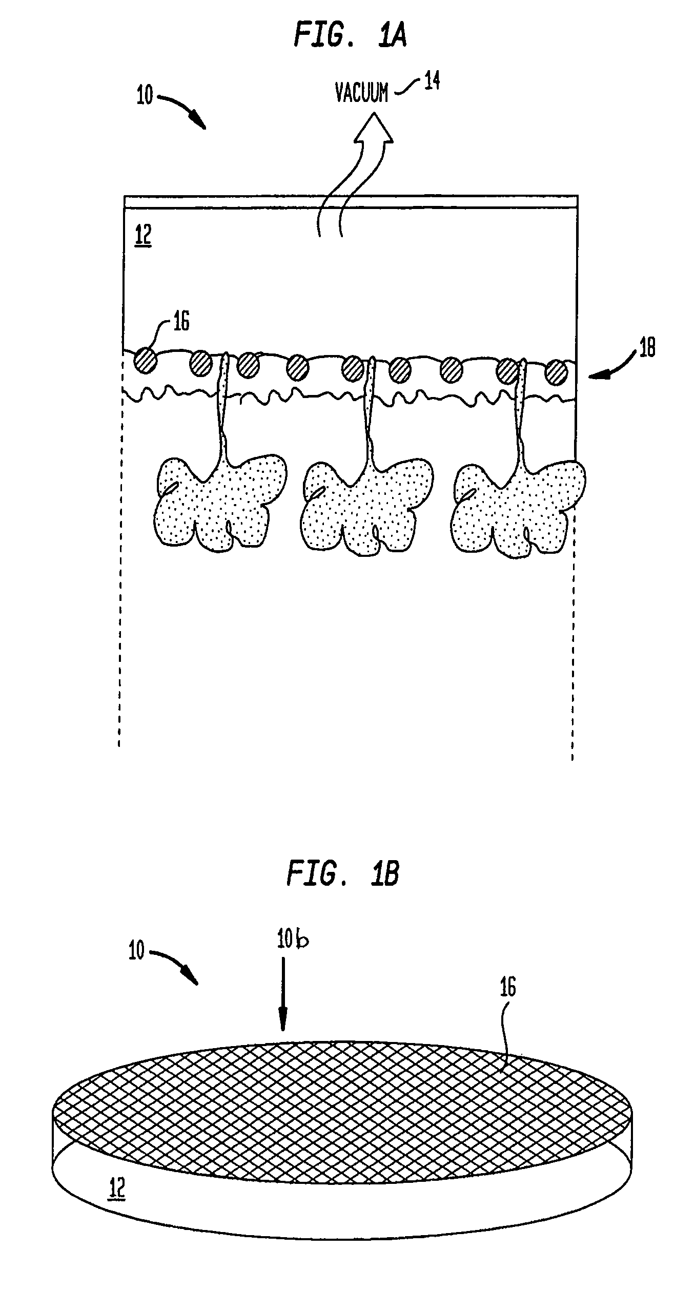 Methods and devices for epithelial protection during photodynamic therapy