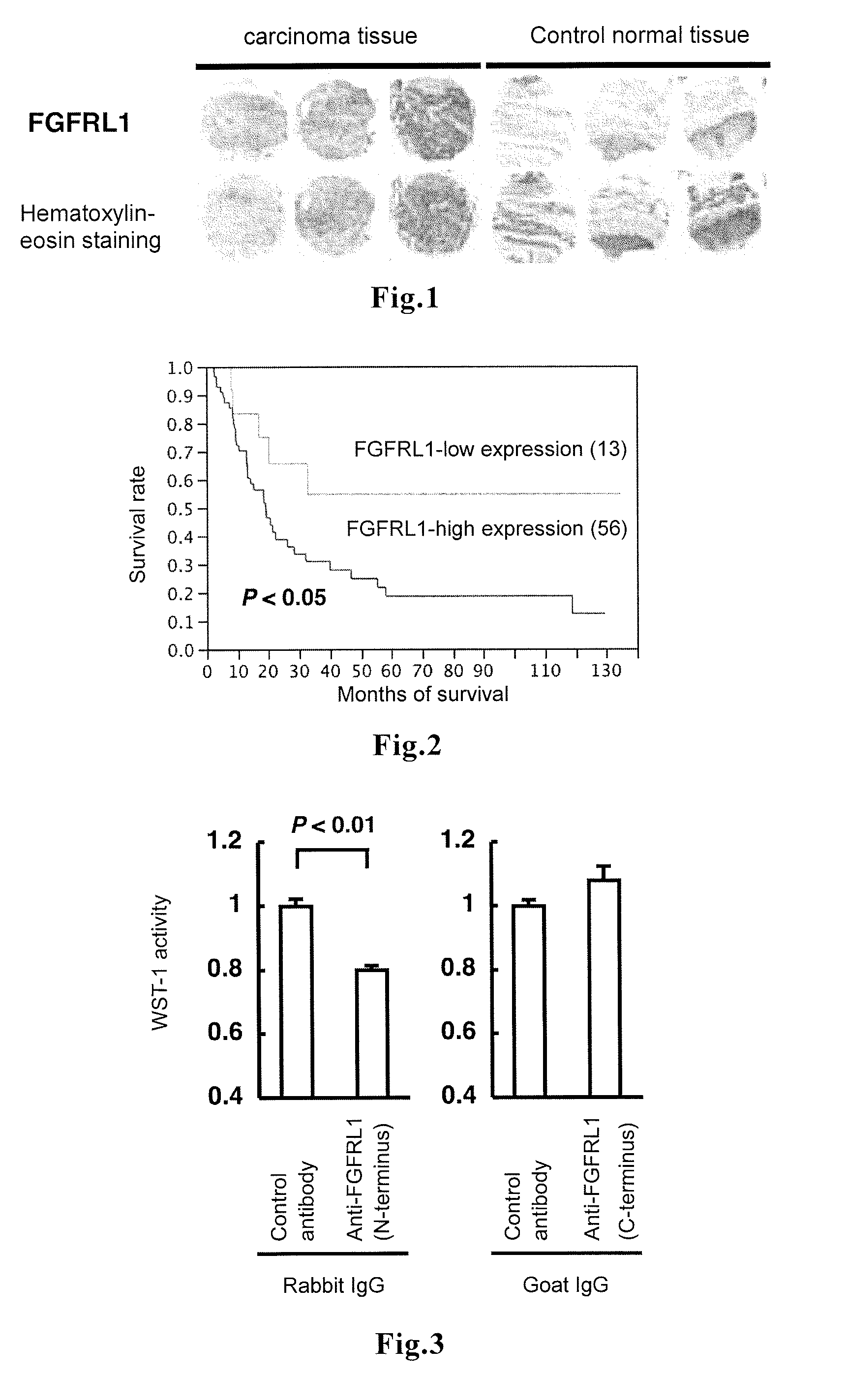 Therapeutic agent for cancer, and method for determining prognosis of cancer