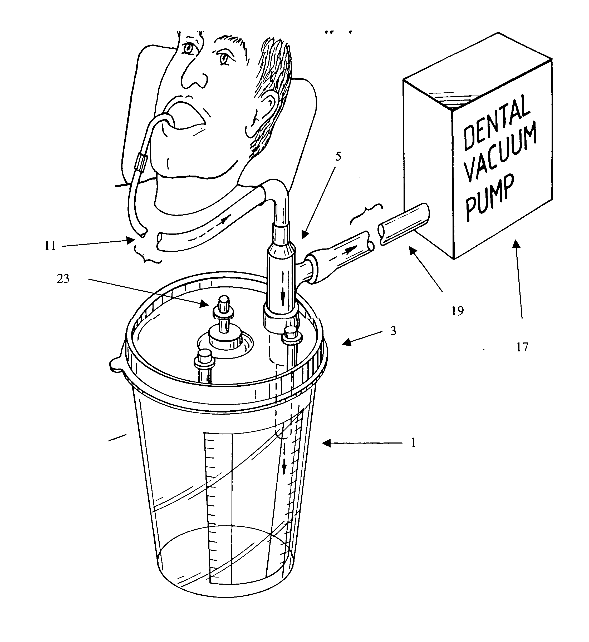 Chair side apparatus for the collection of dental wastewater