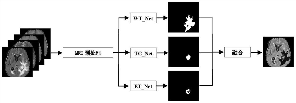 Brain tumor segmentation method of deep residual network based on U-Net architecture.