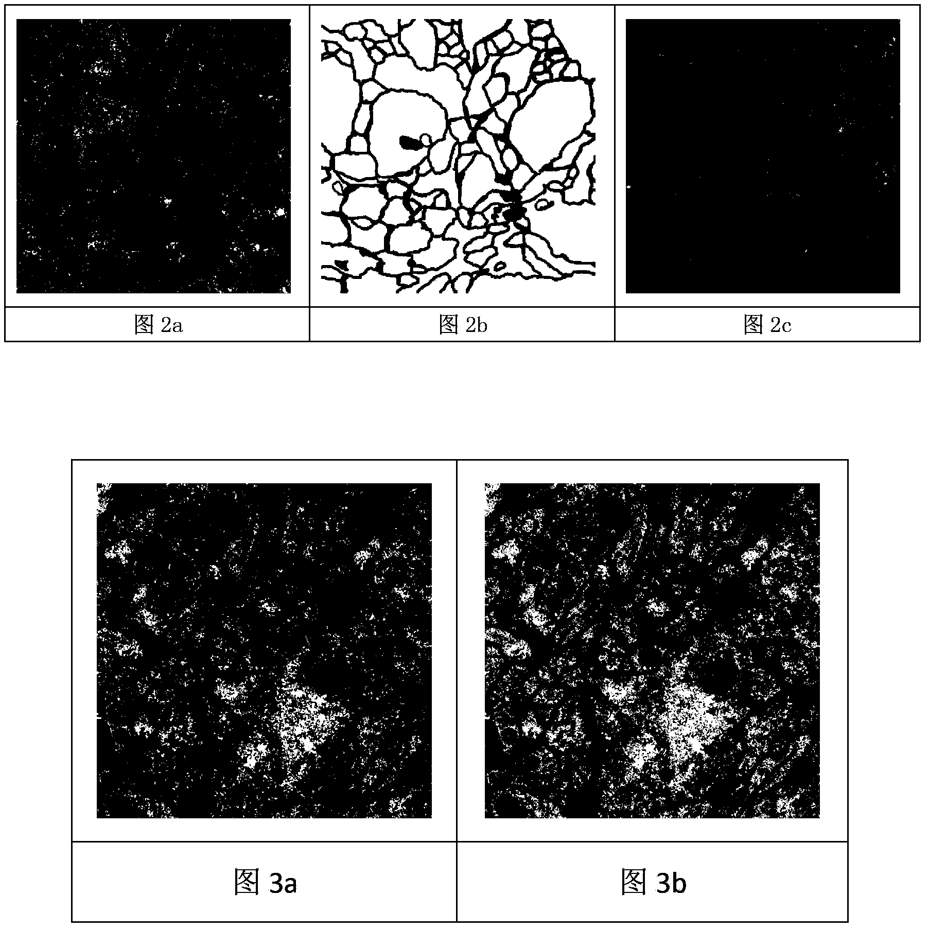 Cell image segmentation method based on automatic feature learning