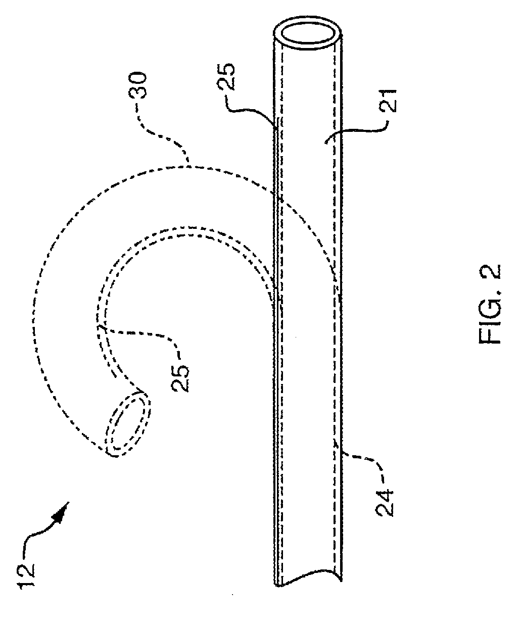 Ablation instrument having deflectable sheath catheters with out-of plane bent tip