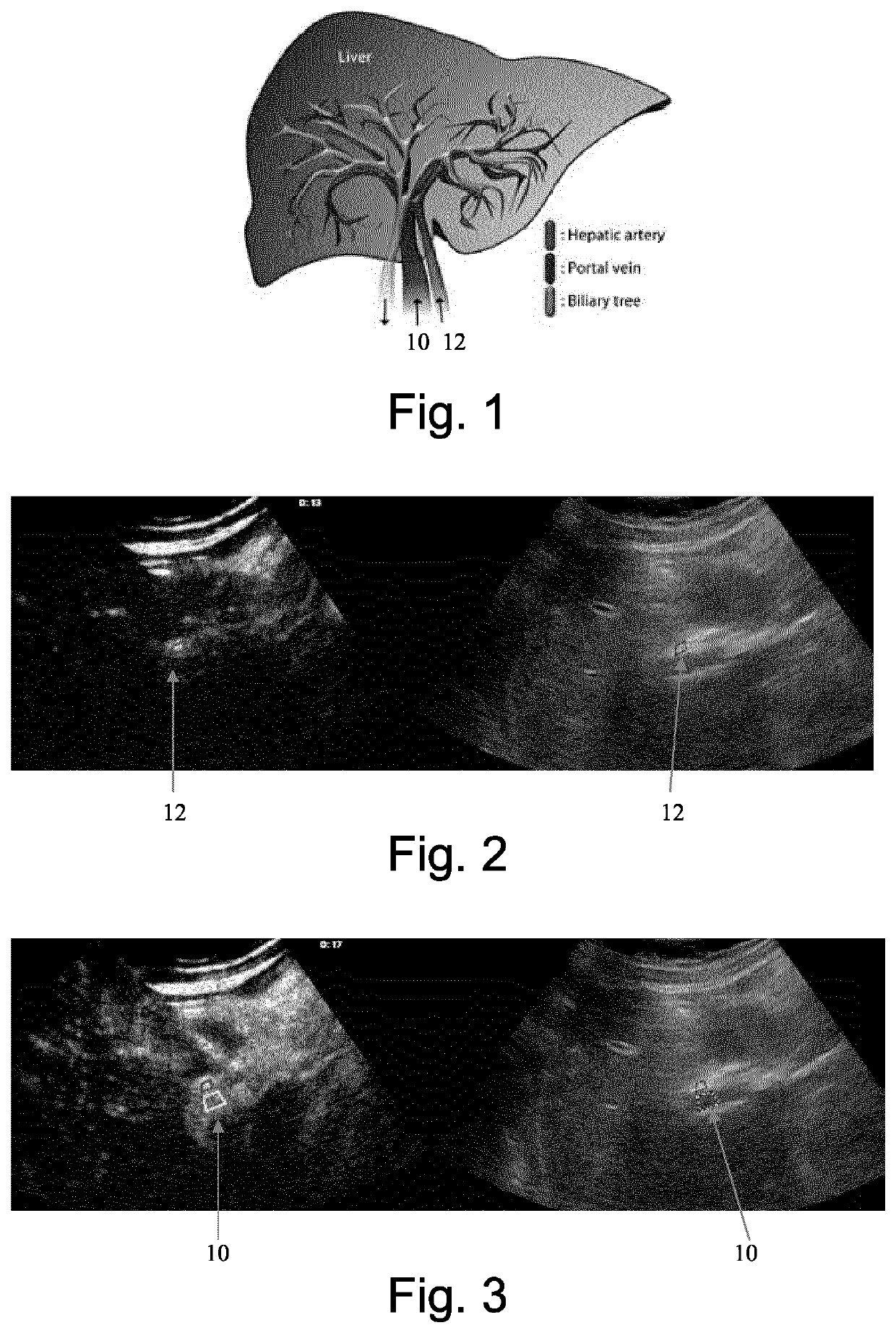 System and method for characterizing liver perfusion of contrast agent flow