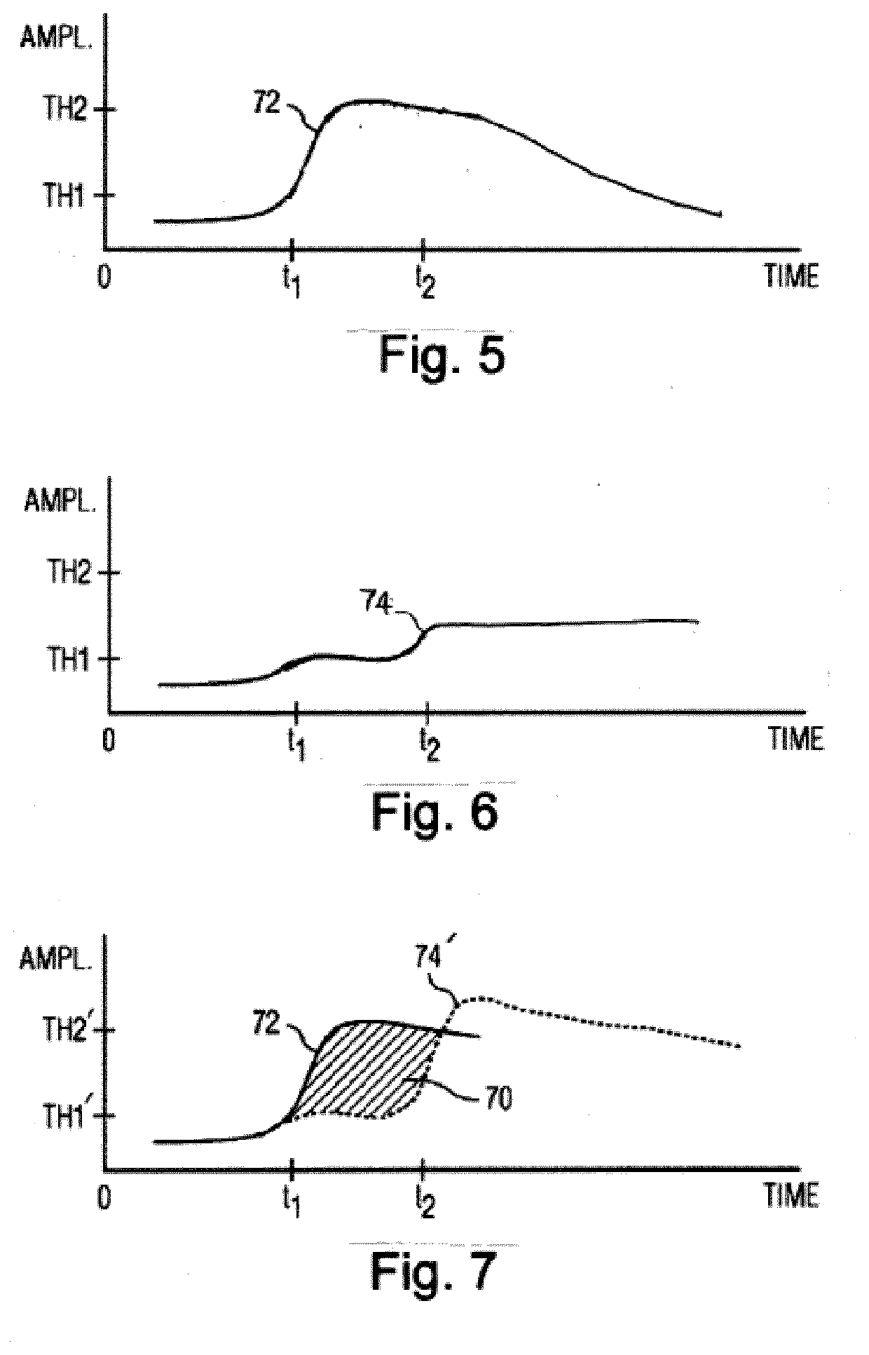 System and method for characterizing liver perfusion of contrast agent flow