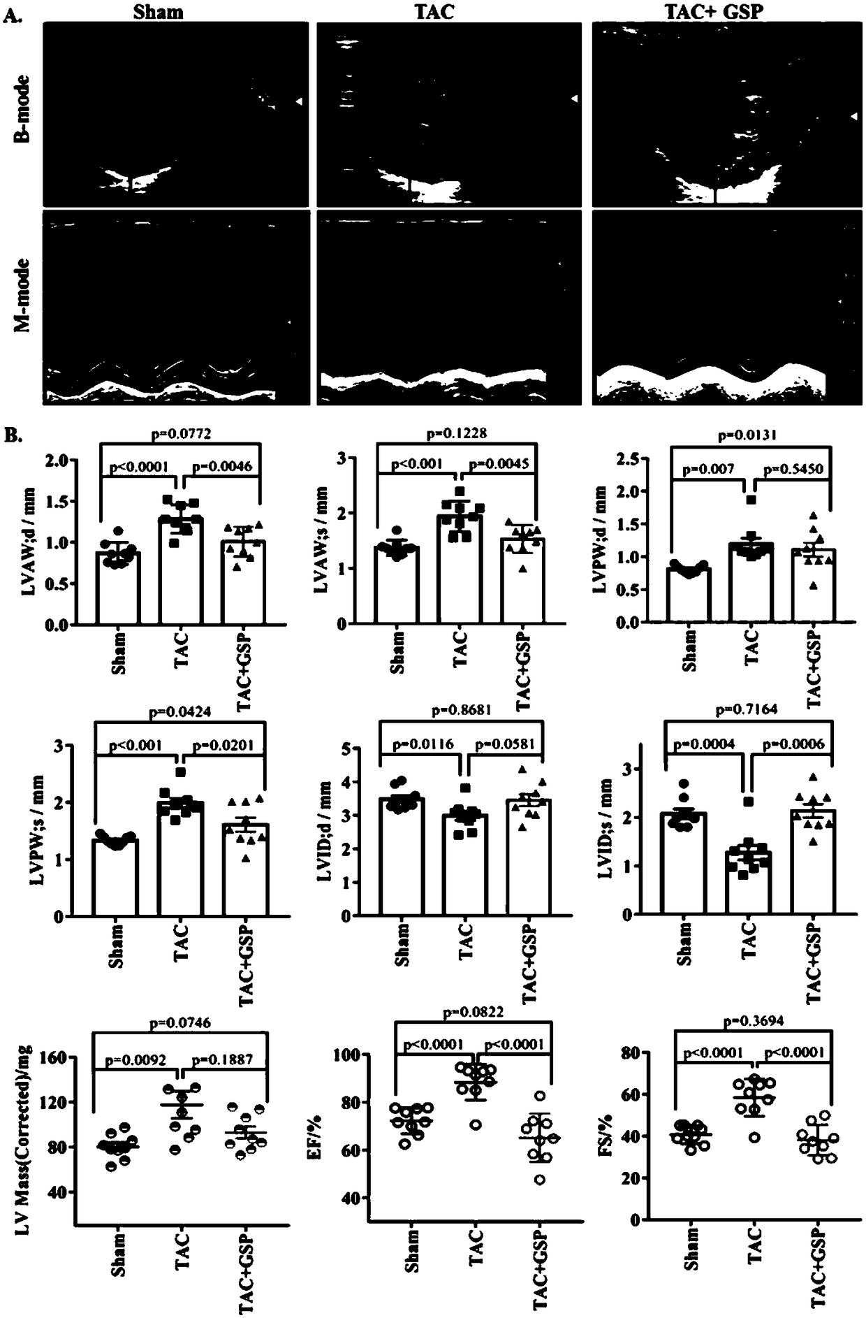 Application of ganoderma lucidum spore powder in preparing medicine for preventing and treating compensatory cardiac hypertrophic heart disease