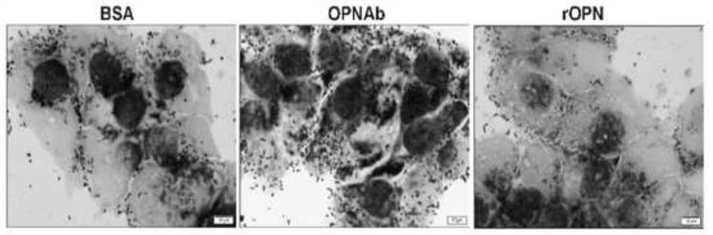 Application of osteopontin as a target molecule in regulating intestinal flora colonization