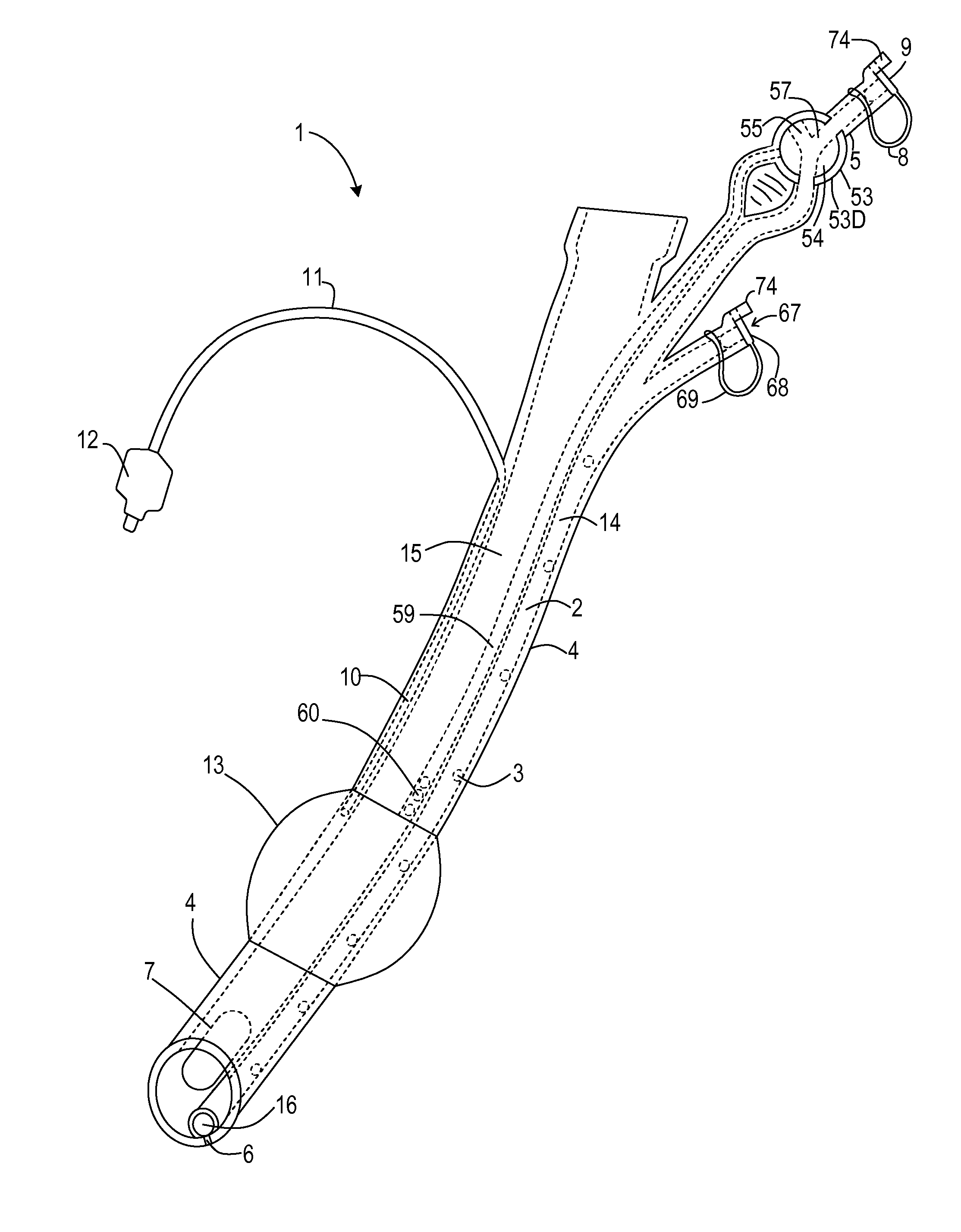 Endotracheal tube with intrinsic suction and endotracheal suction control valve
