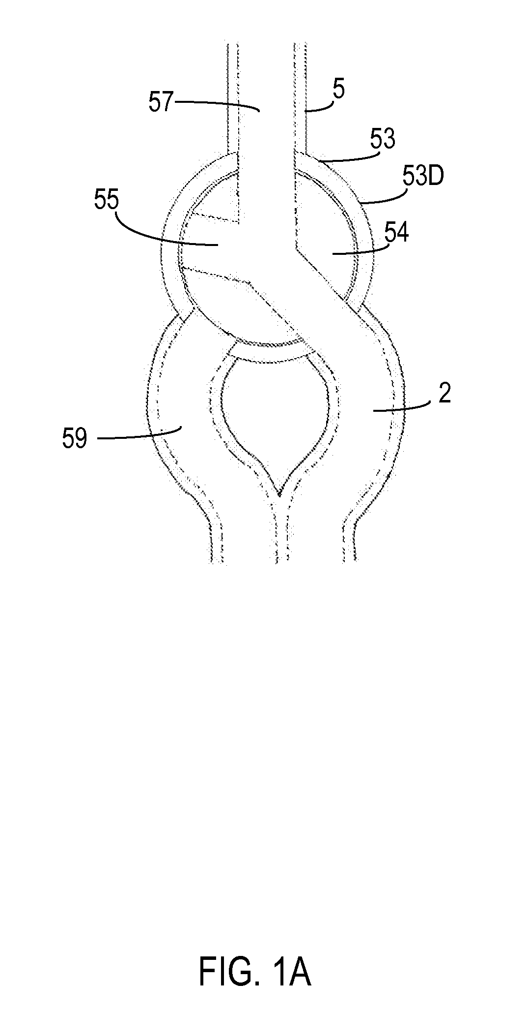 Endotracheal tube with intrinsic suction and endotracheal suction control valve