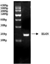 Unlabeled tuberculosis fusion protein ESAT6-Ag85B