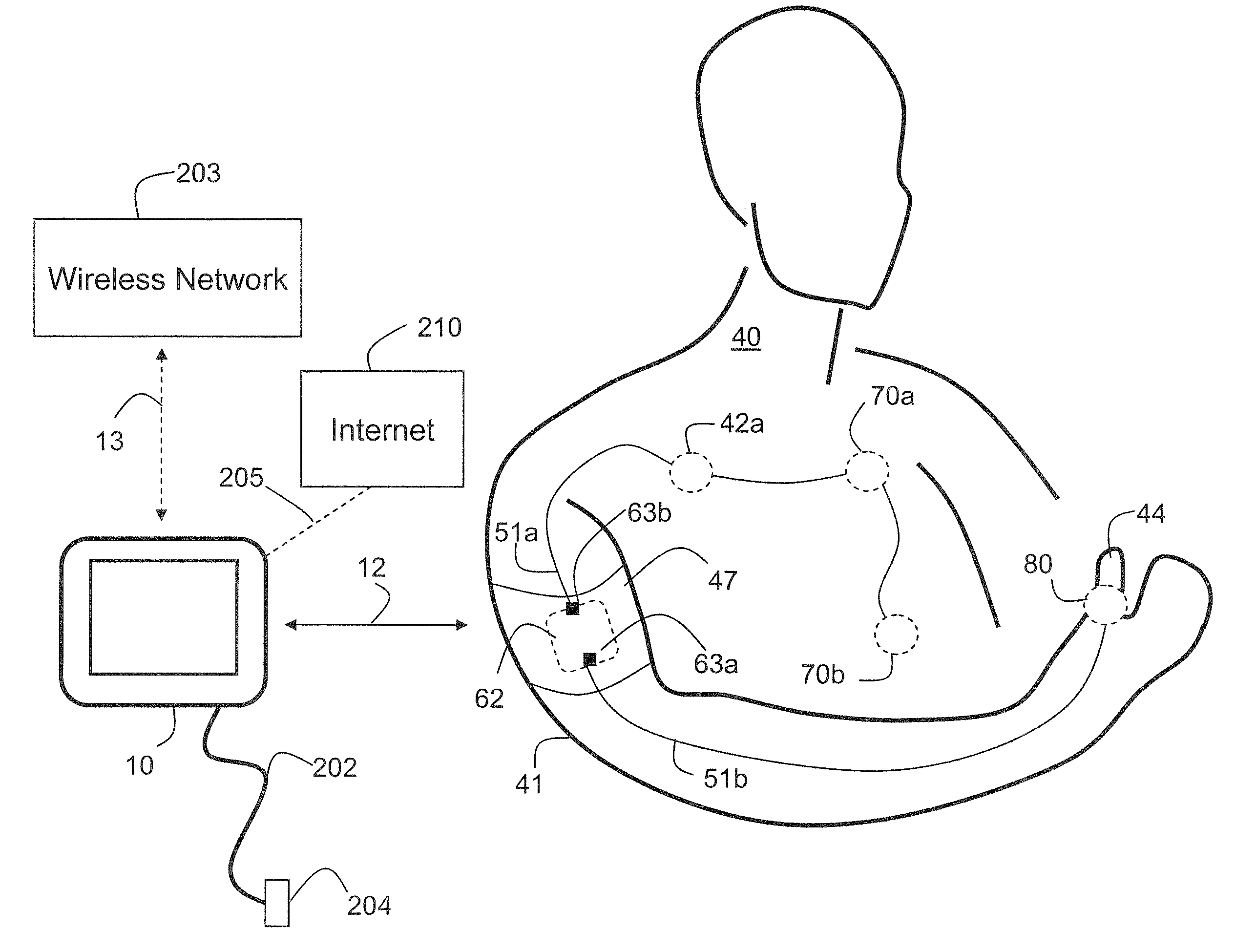 Device for determining respiratory rate and other vital signs