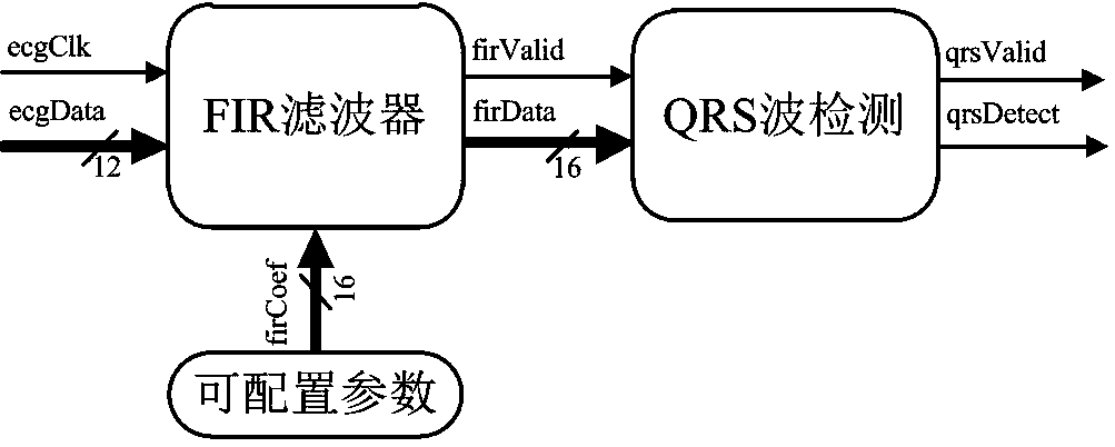 ASIC chip for electrocardiosignal QRS wave real-time detection