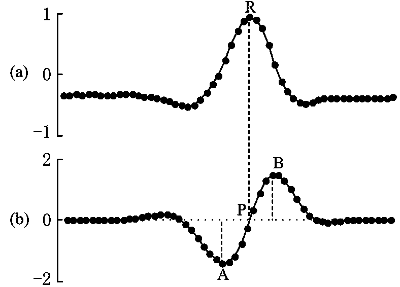 ASIC chip for electrocardiosignal QRS wave real-time detection