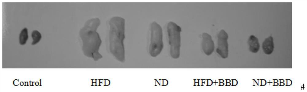 Application of Babaodan in the preparation of medicine for treating obesity