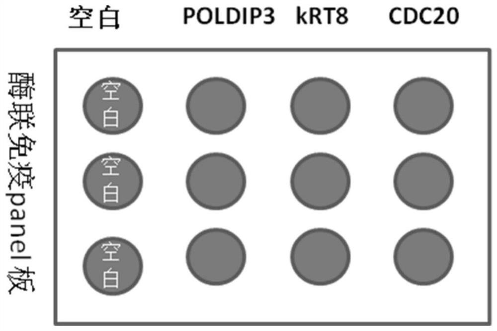 Early stage specific autoantibody panel diagnostic kit for small cell carcinoma of the lung